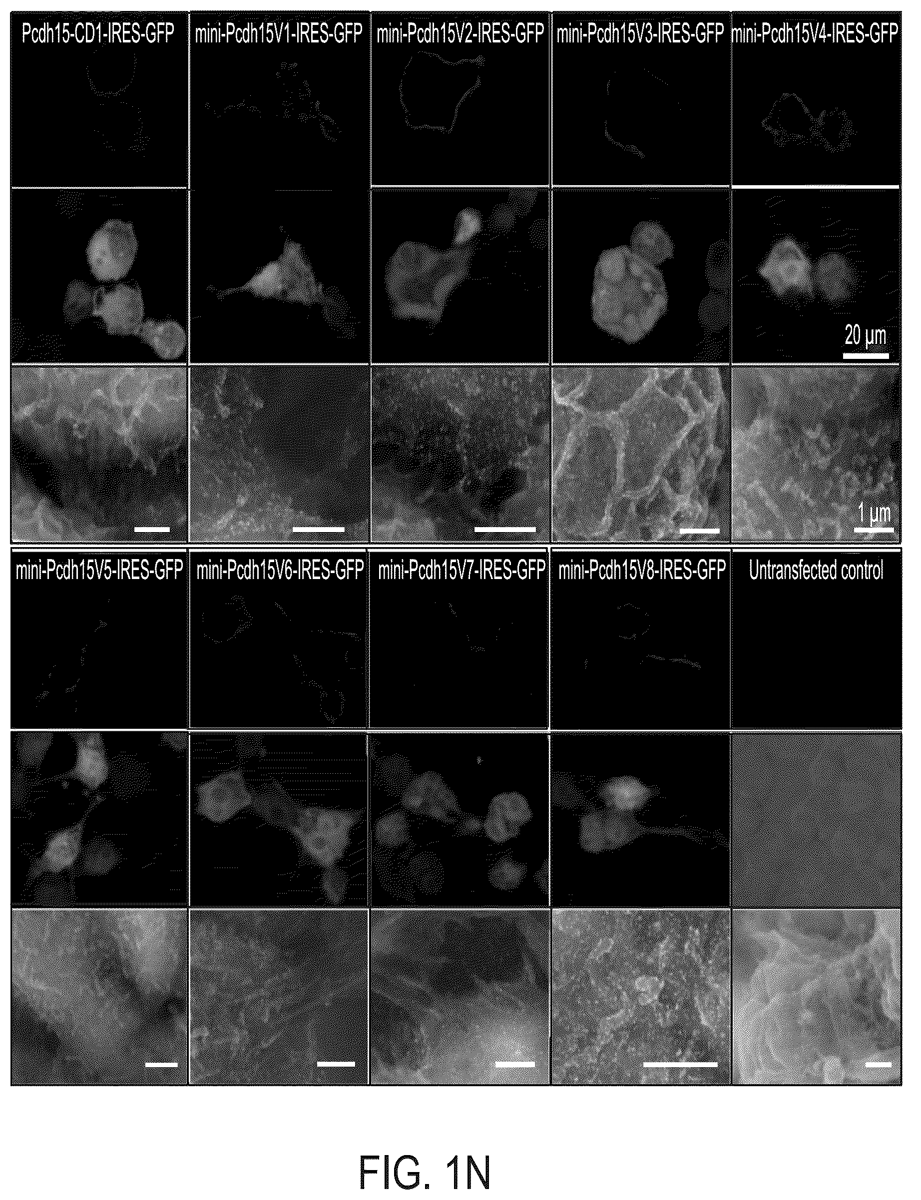 Patent US12612645 Figure 10 – AAV vectors encoding mini-PCDH15 and uses thereof