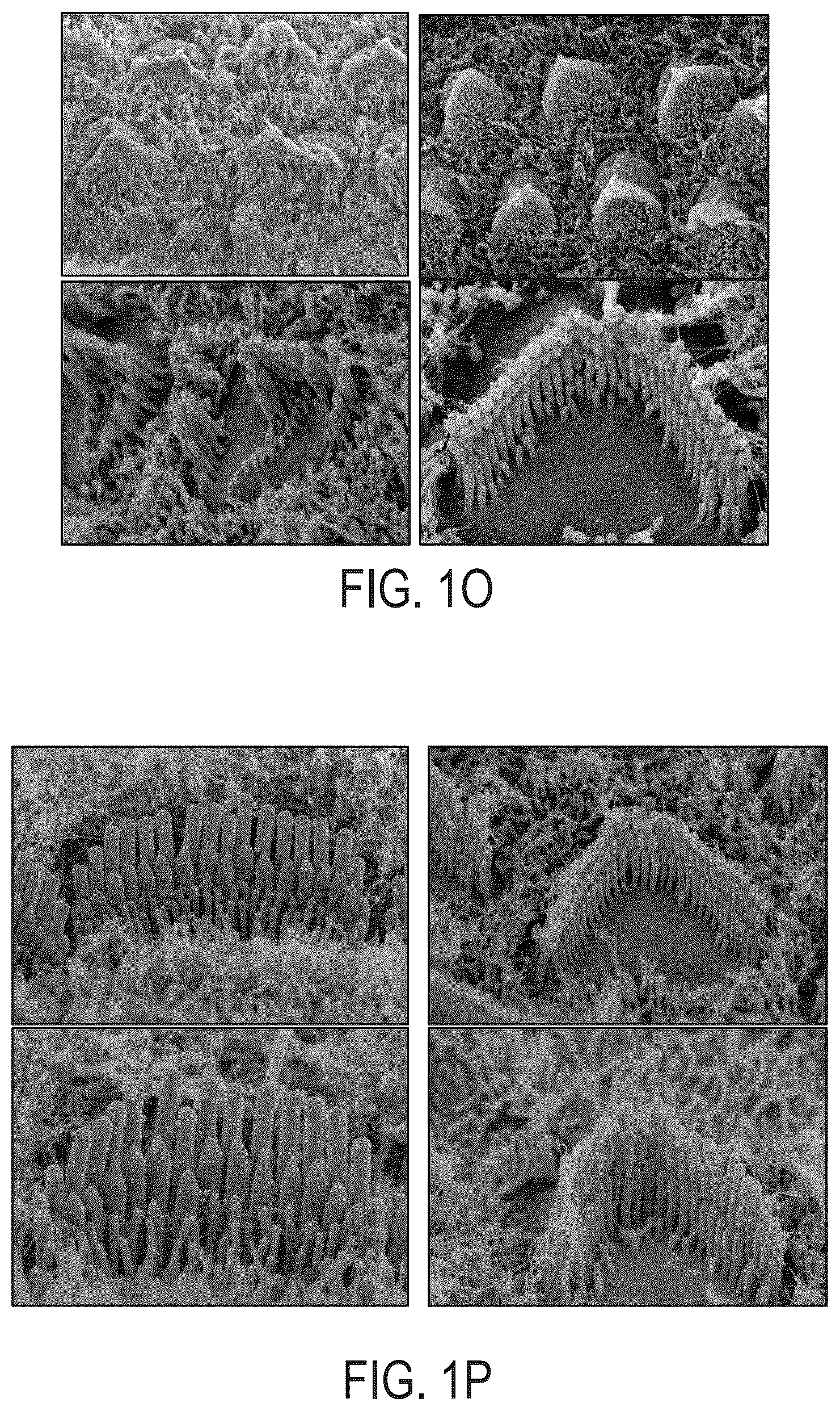 Patent US12612645 Figure 11 – AAV vectors encoding mini-PCDH15 and uses thereof