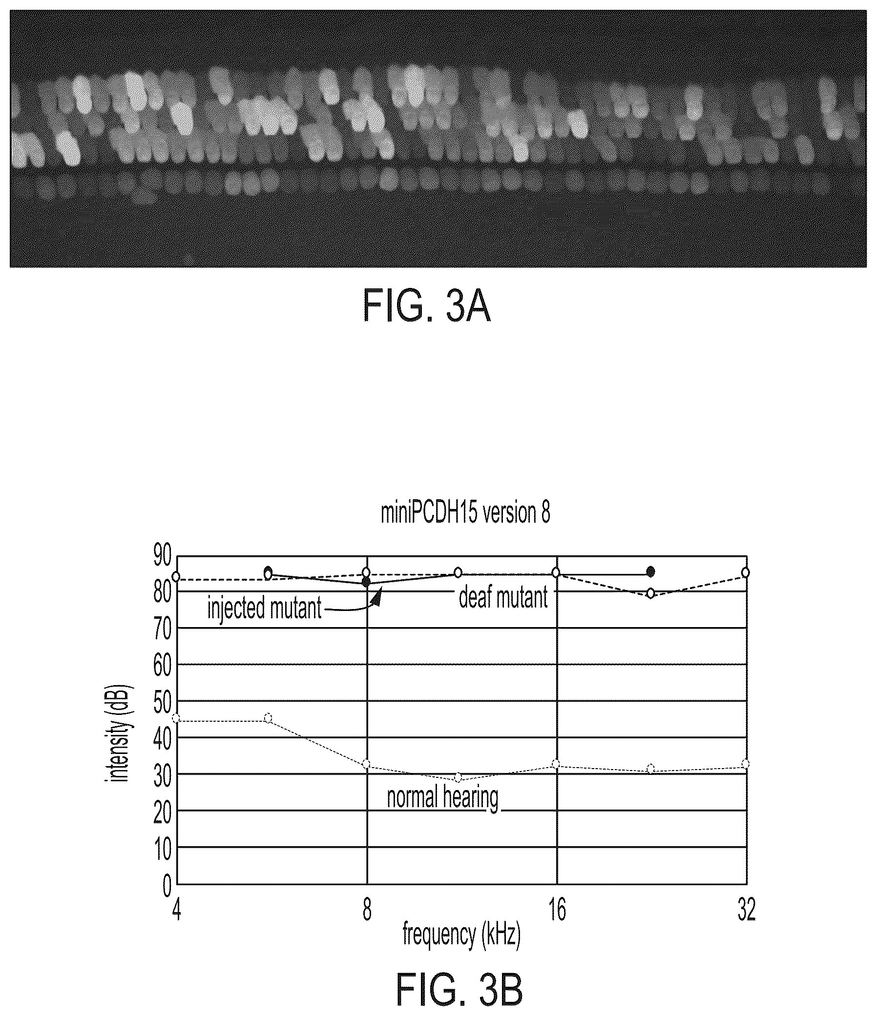 Patent US12612645 Figure 15 – AAV vectors encoding mini-PCDH15 and uses thereof
