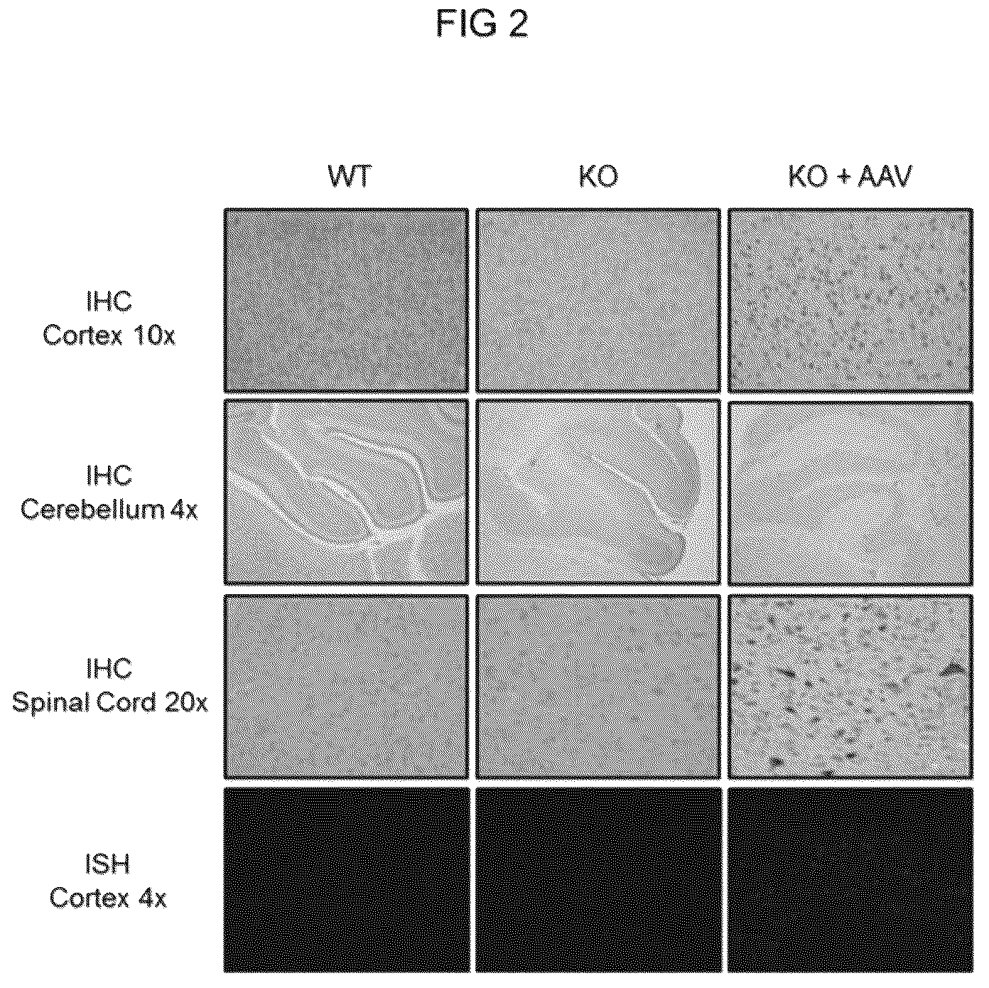 Patent US12612647 Figure 3 – Compositions useful in treatment of spinal muscular atrophy