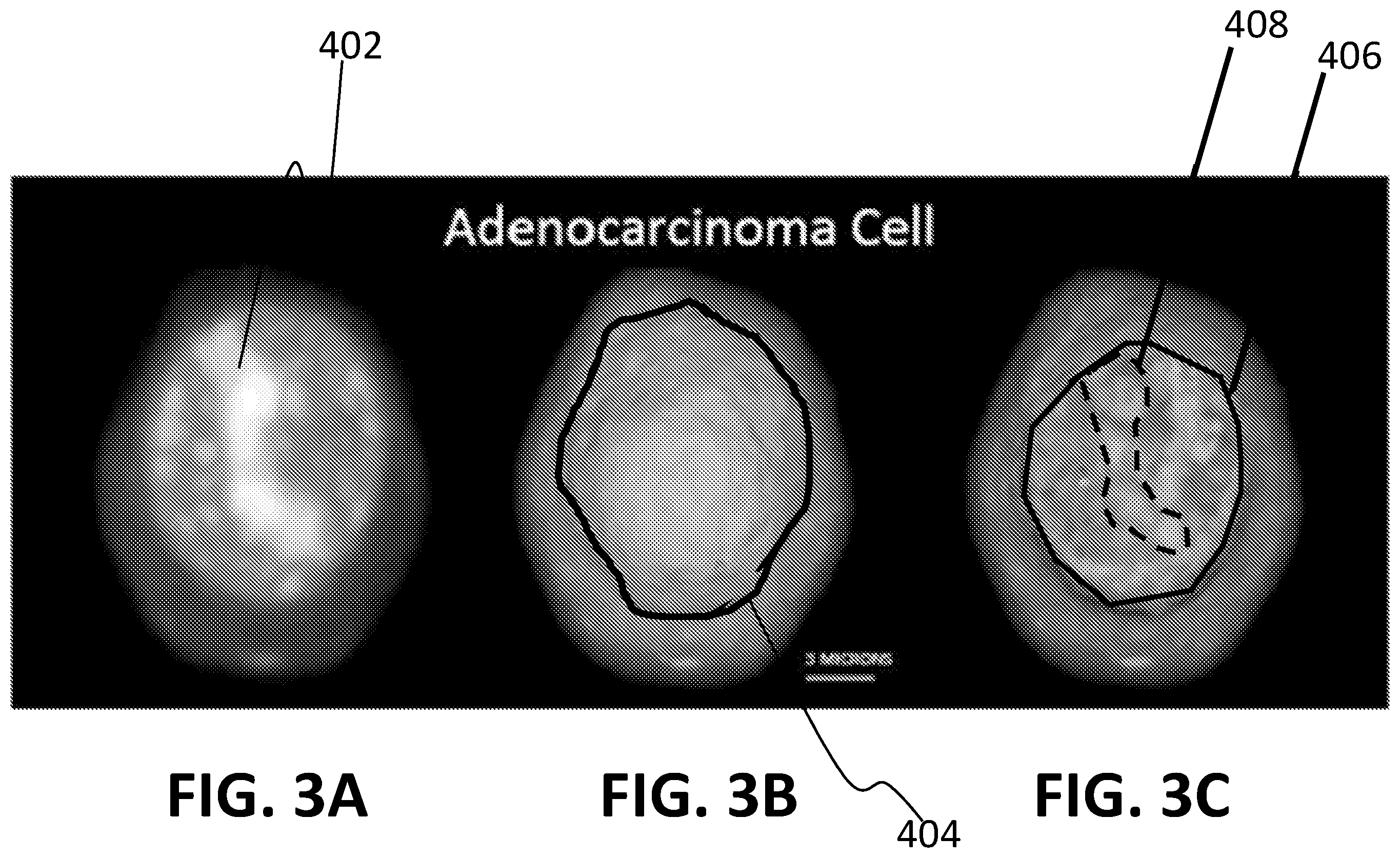 Patent US12612663 Figure 3 – Morphometric detection of DNA mismatch repair deficiency
