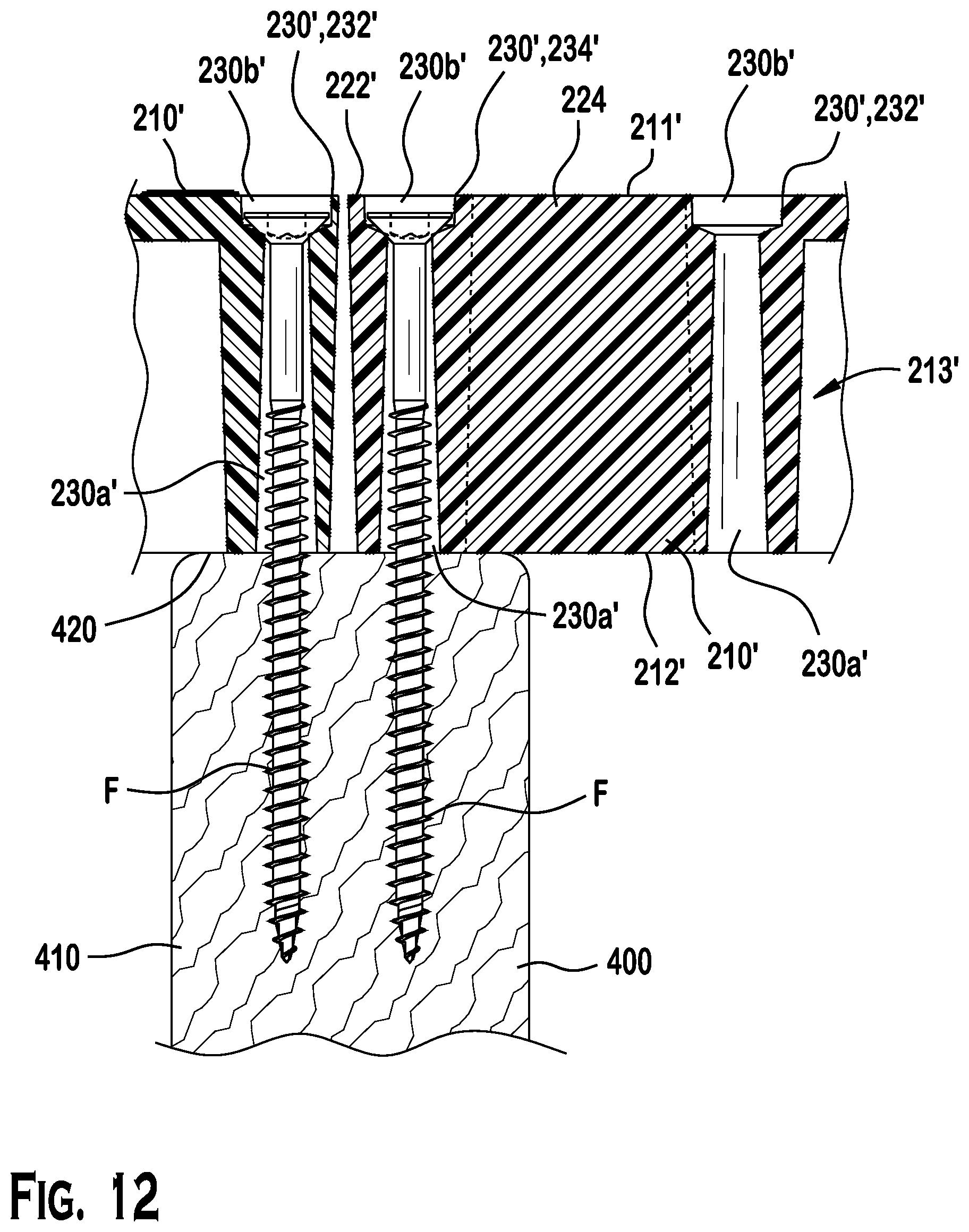 Patent US12612742 Figure 11 – Paver supporting apparatus