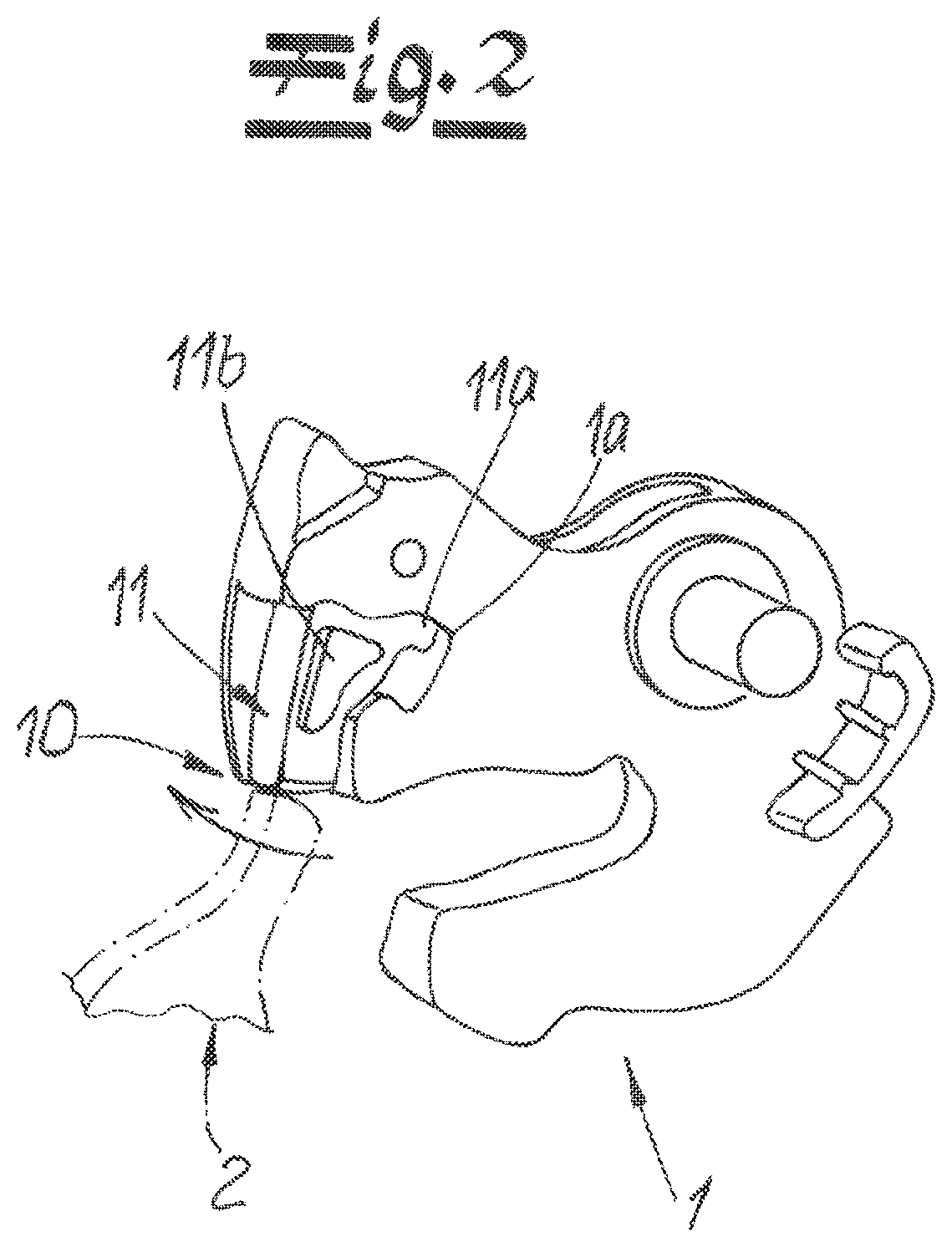 Patent US12612807 Figure 2 – Motor vehicle lock, in particular motor vehicle door lock