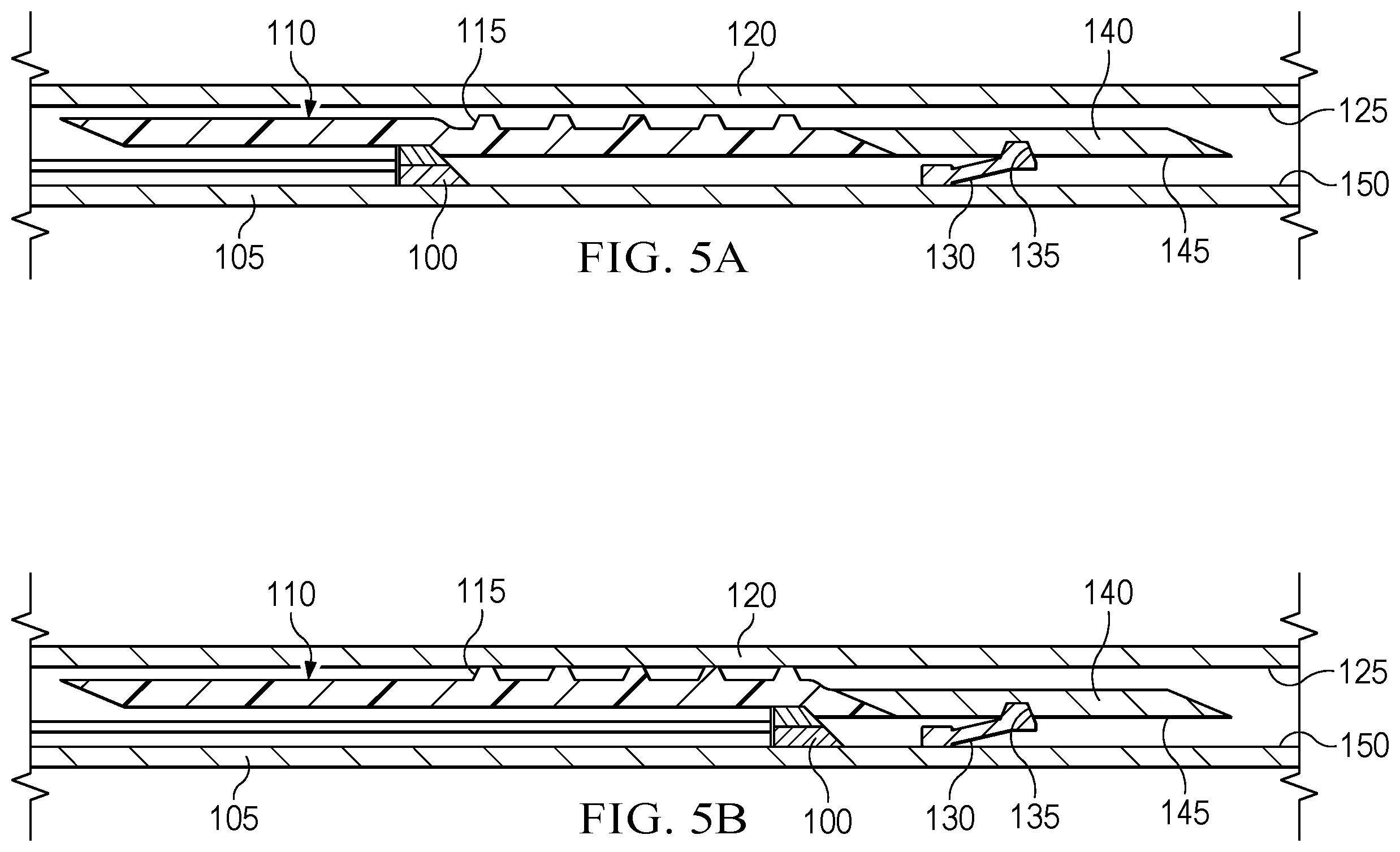 Patent US12612843 Figure 3 – Mechanical support for expandable liner hanger