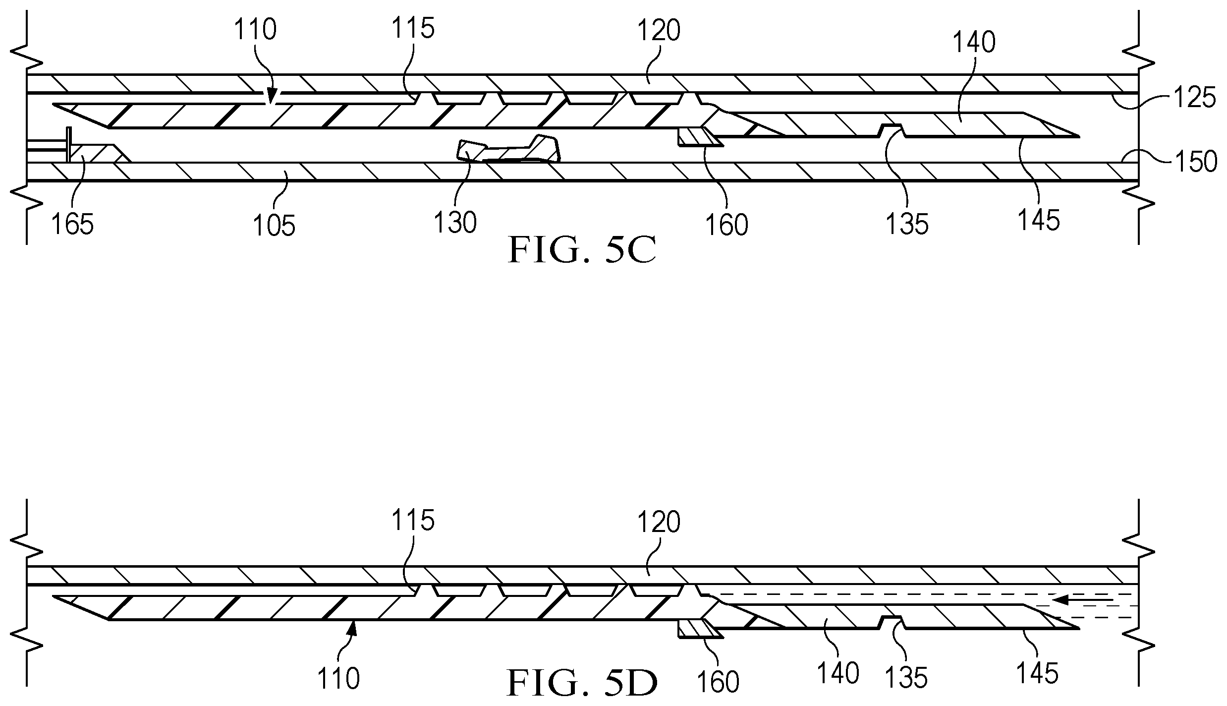 Patent US12612843 Figure 4 – Mechanical support for expandable liner hanger