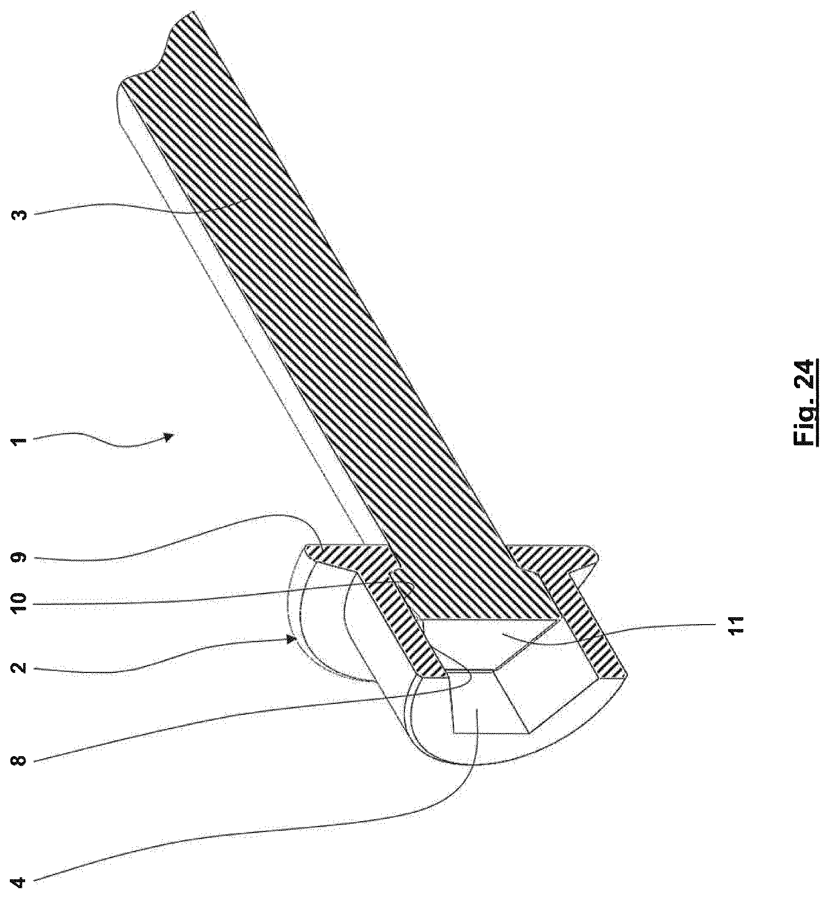Patent US12612936 Figure 20 – Two-piece high-strength screw