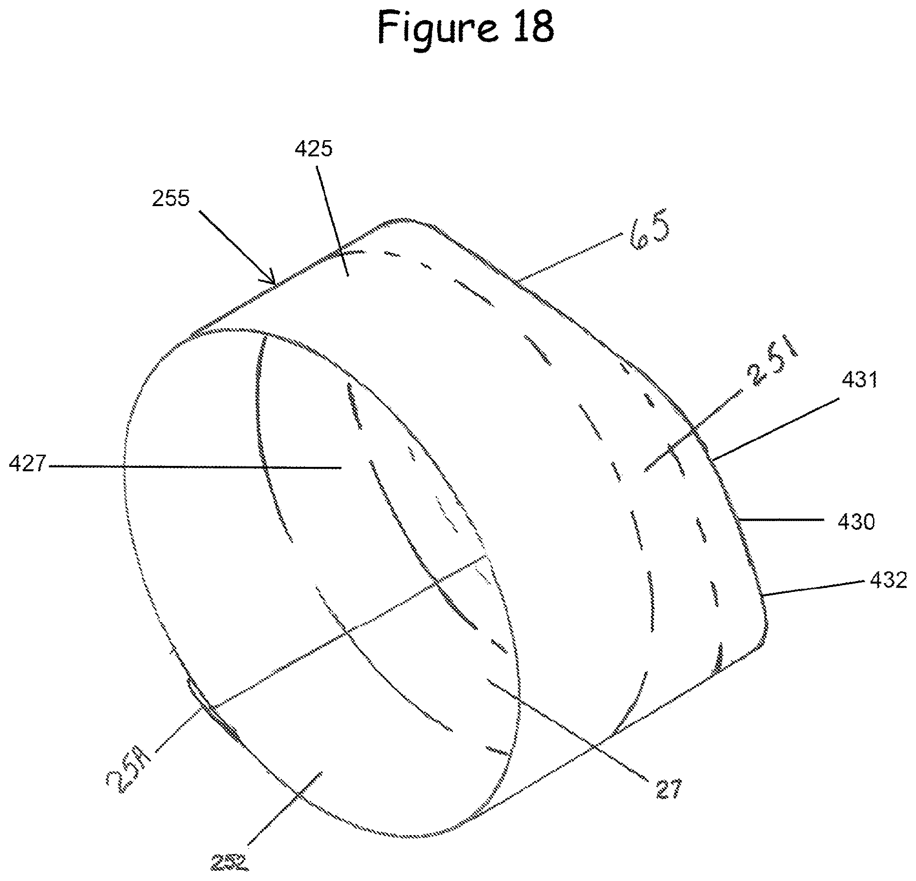 Patent US12612993 Figure 18 – Gate insert valve and method of insertion into pressurized pipelines