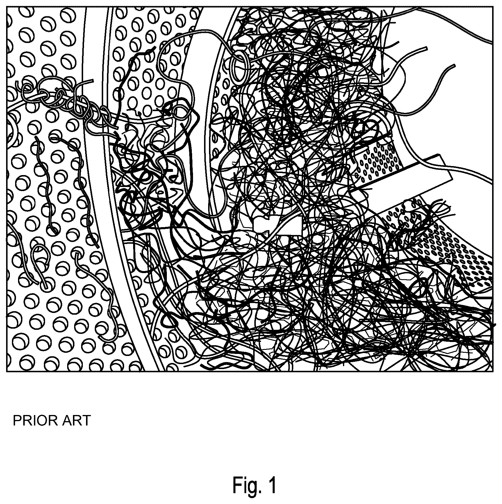 Patent US12613029 Figure 1 – Device and method for sorting a particulate stream