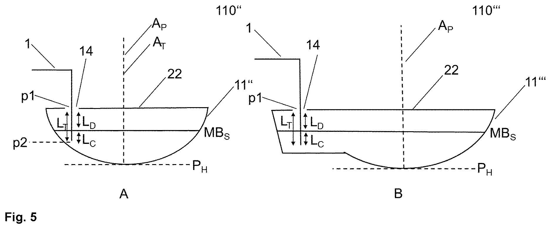 Patent US12613138 Figure 4 – Method and system for determining a temperature value of a molten metal bath