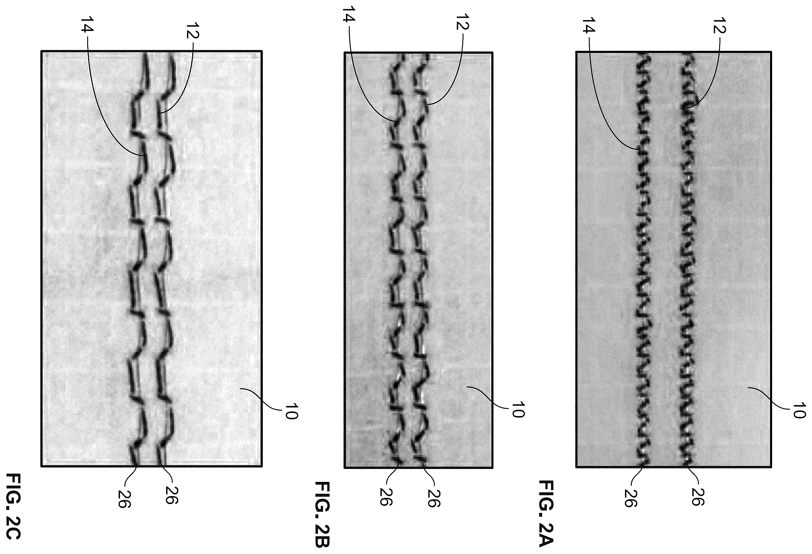 Patent US12613154 Figure 2 – Resistance-based textile impact sensor systems