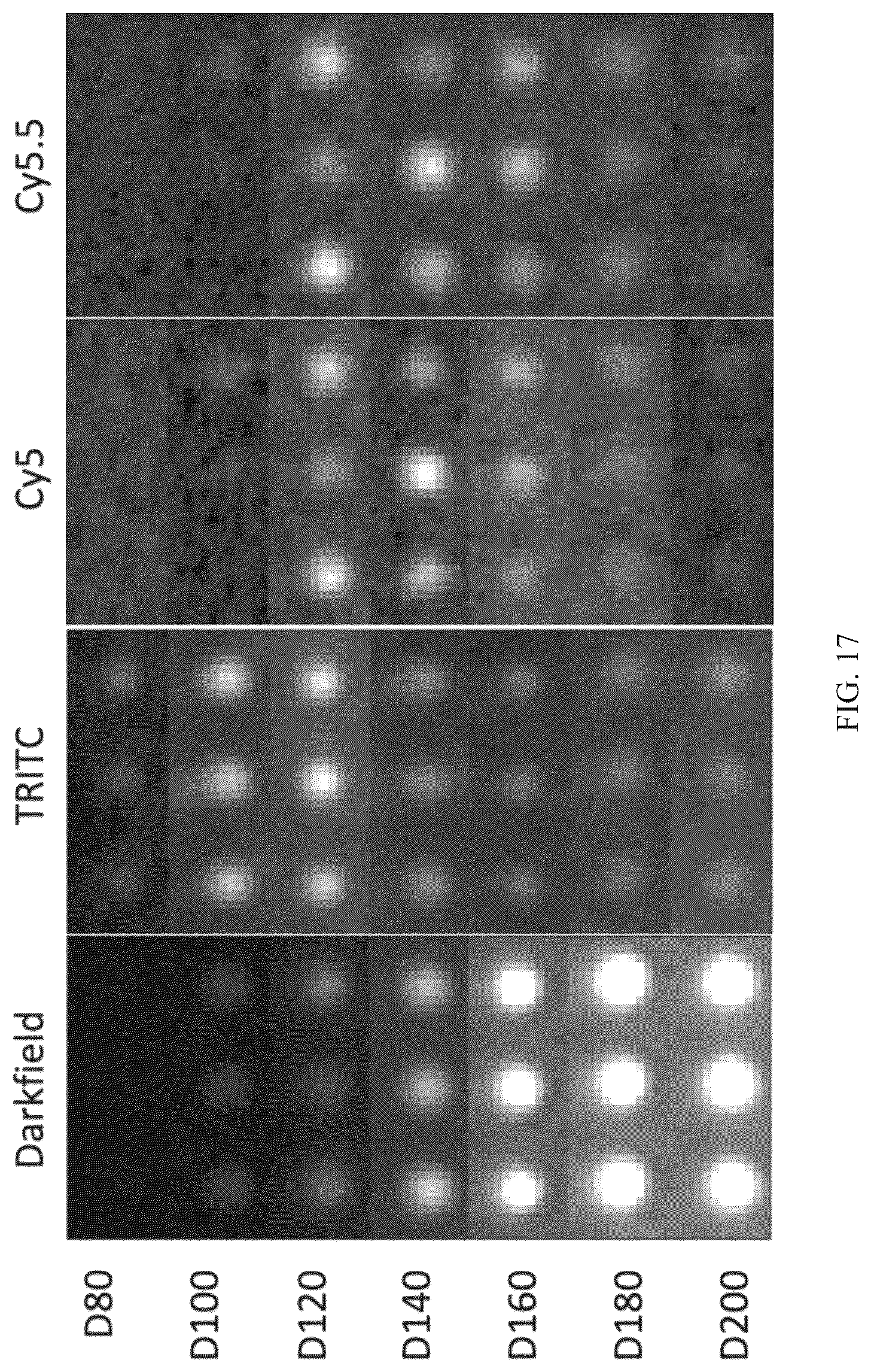 Patent US12613188 Figure 17 – Methods and systems of enhancing electromagnetic radiation signals from extracellular vesicles