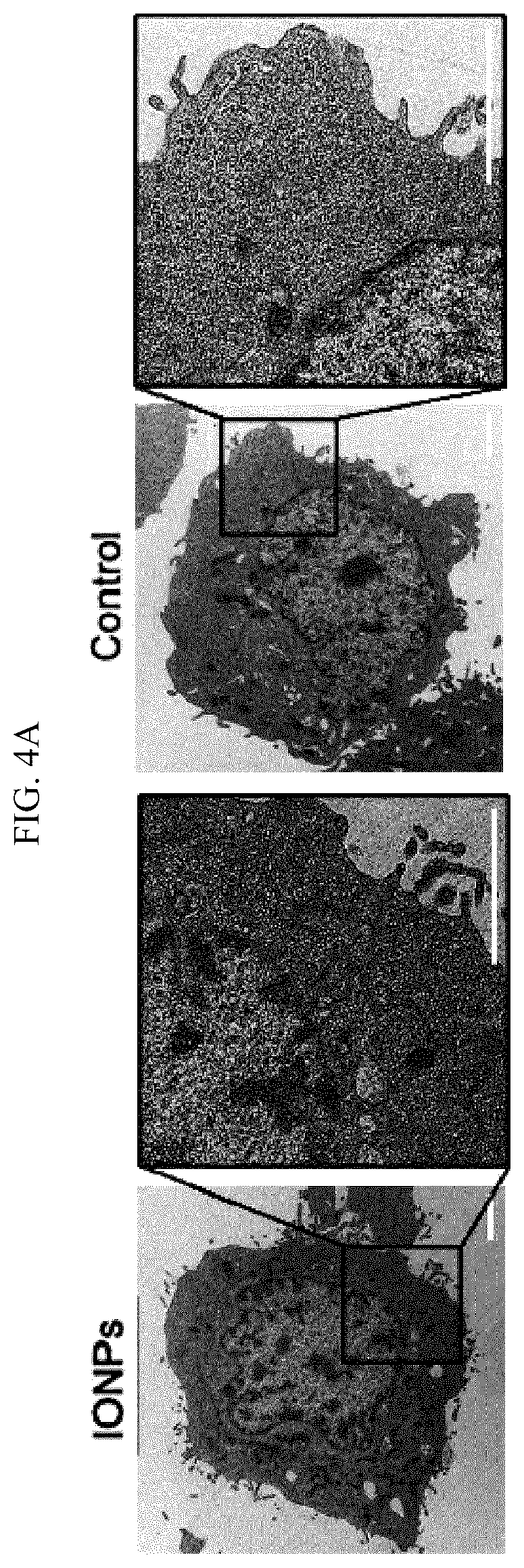 Patent US12613204 Figure 9 – Method for analyzing endosomal escape efficiency of drug delivery particles