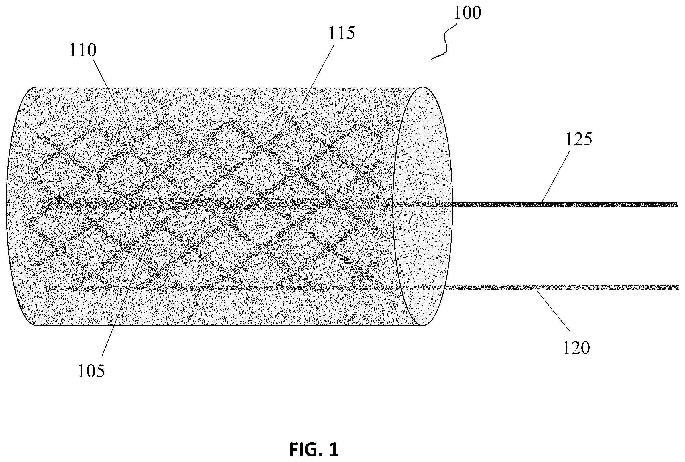 Patent US12613209 — Embedded sensor system for measurement and monitoring of the pore solution electrical resistivity in concrete materials and structures — Figure 1