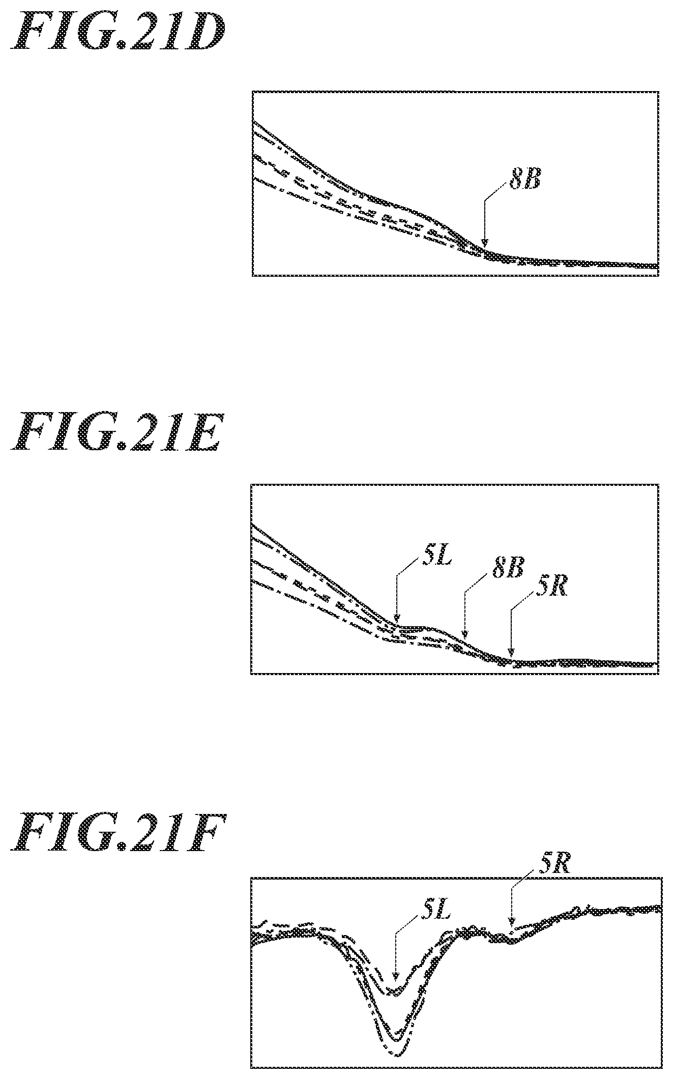 Patent US12613221 Figure 18 – Information processing system for nondestructive inspection and nondestructive inspection method