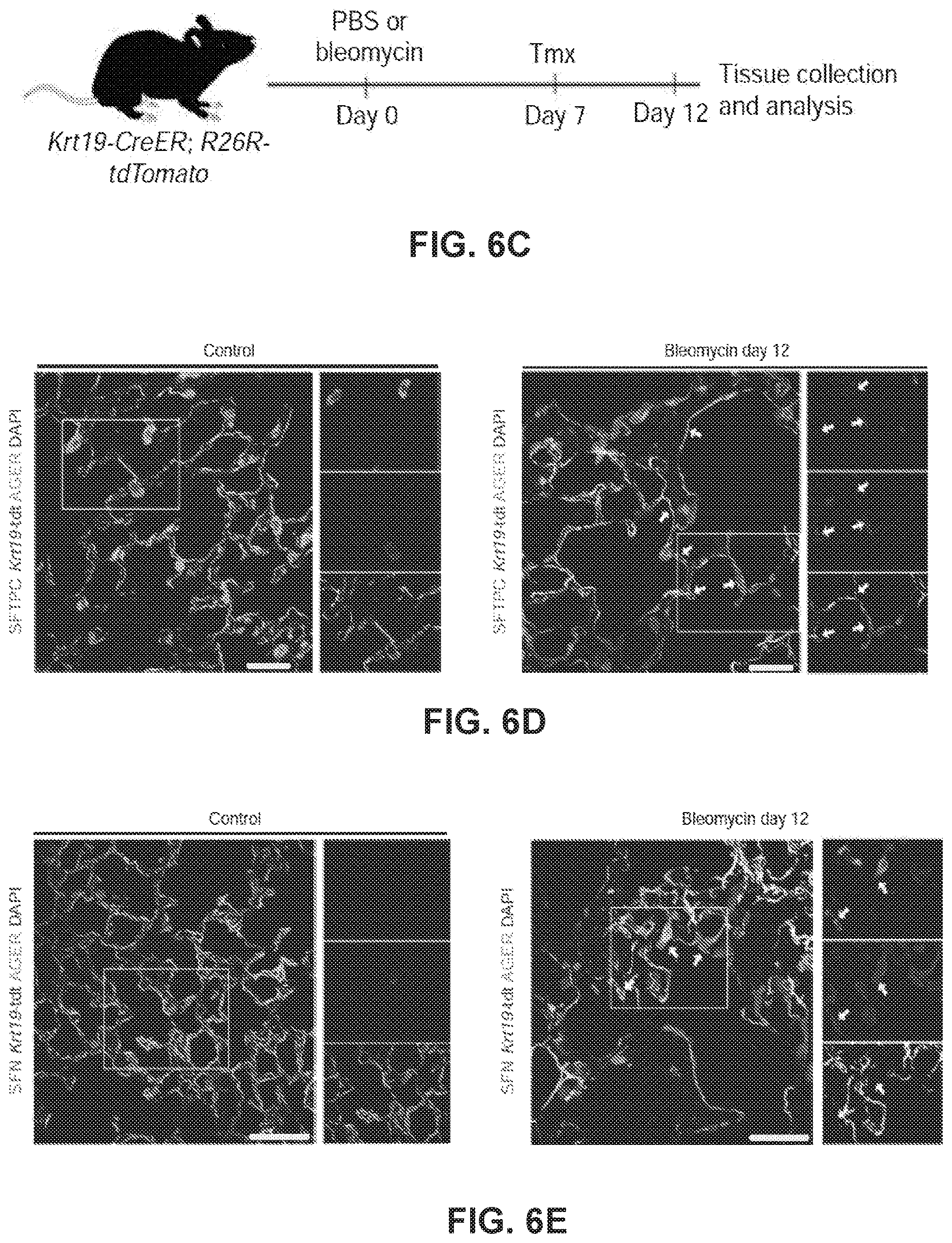 Patent US12613236 Figure 10 – Lung fibrosis model and methods of using the same