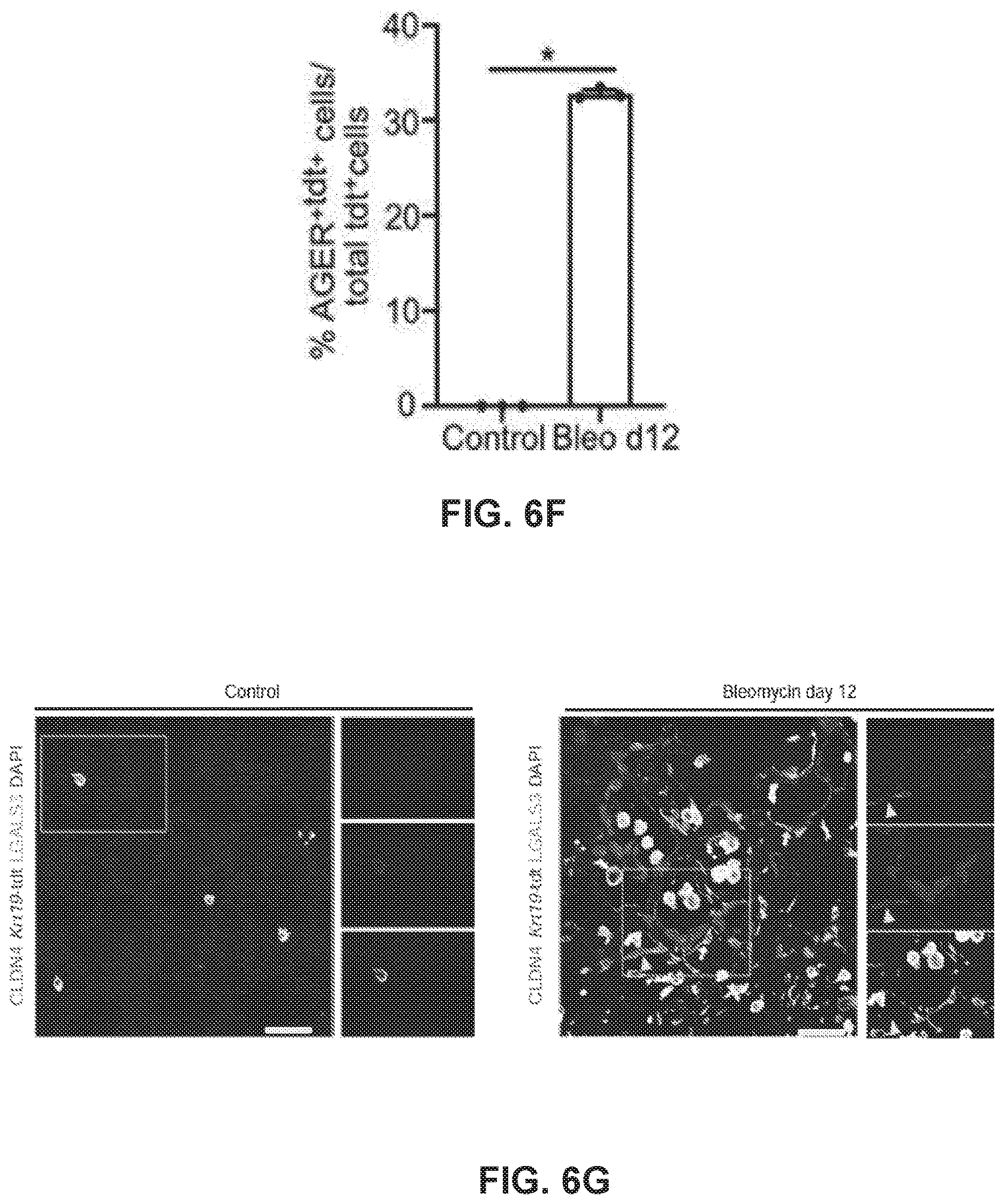 Patent US12613236 Figure 11 – Lung fibrosis model and methods of using the same