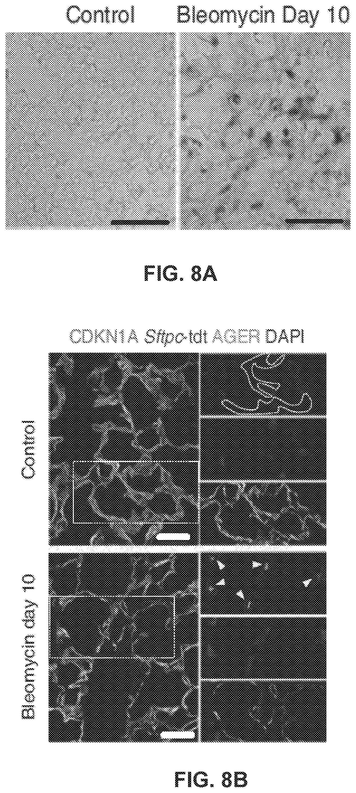 Patent US12613236 Figure 16 – Lung fibrosis model and methods of using the same