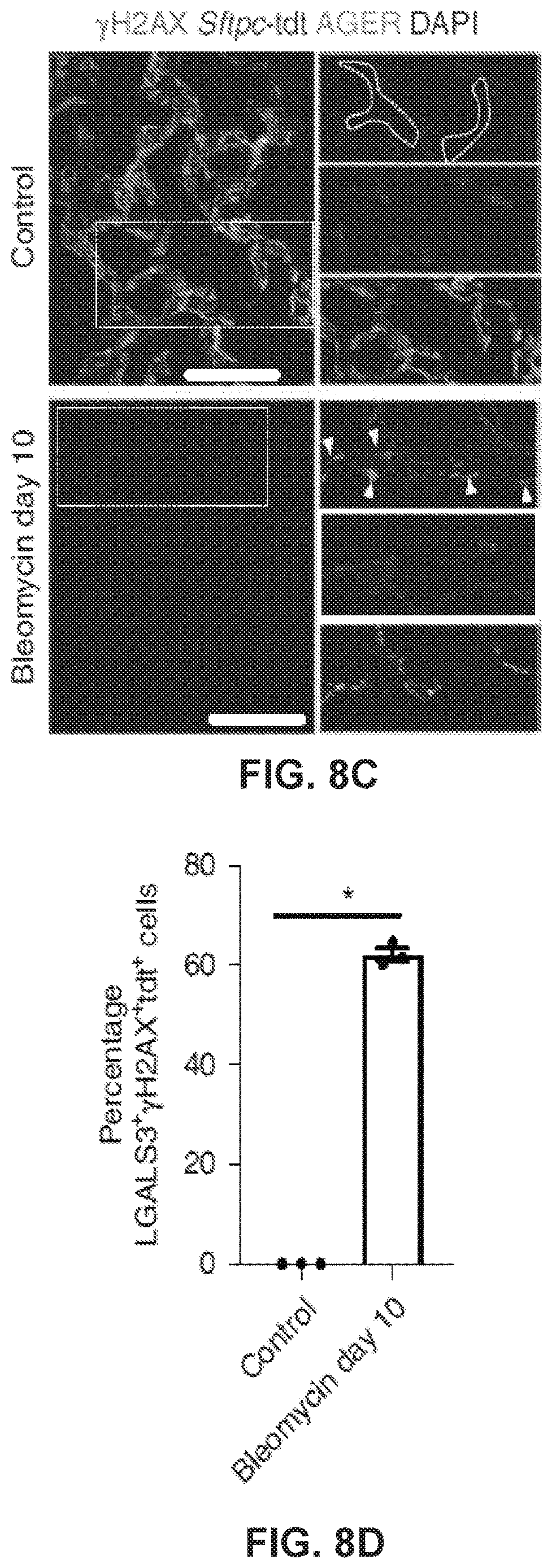 Patent US12613236 Figure 17 – Lung fibrosis model and methods of using the same