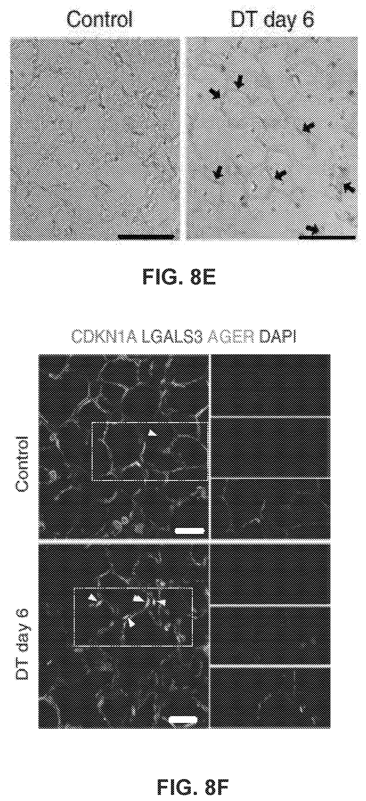 Patent US12613236 Figure 18 – Lung fibrosis model and methods of using the same