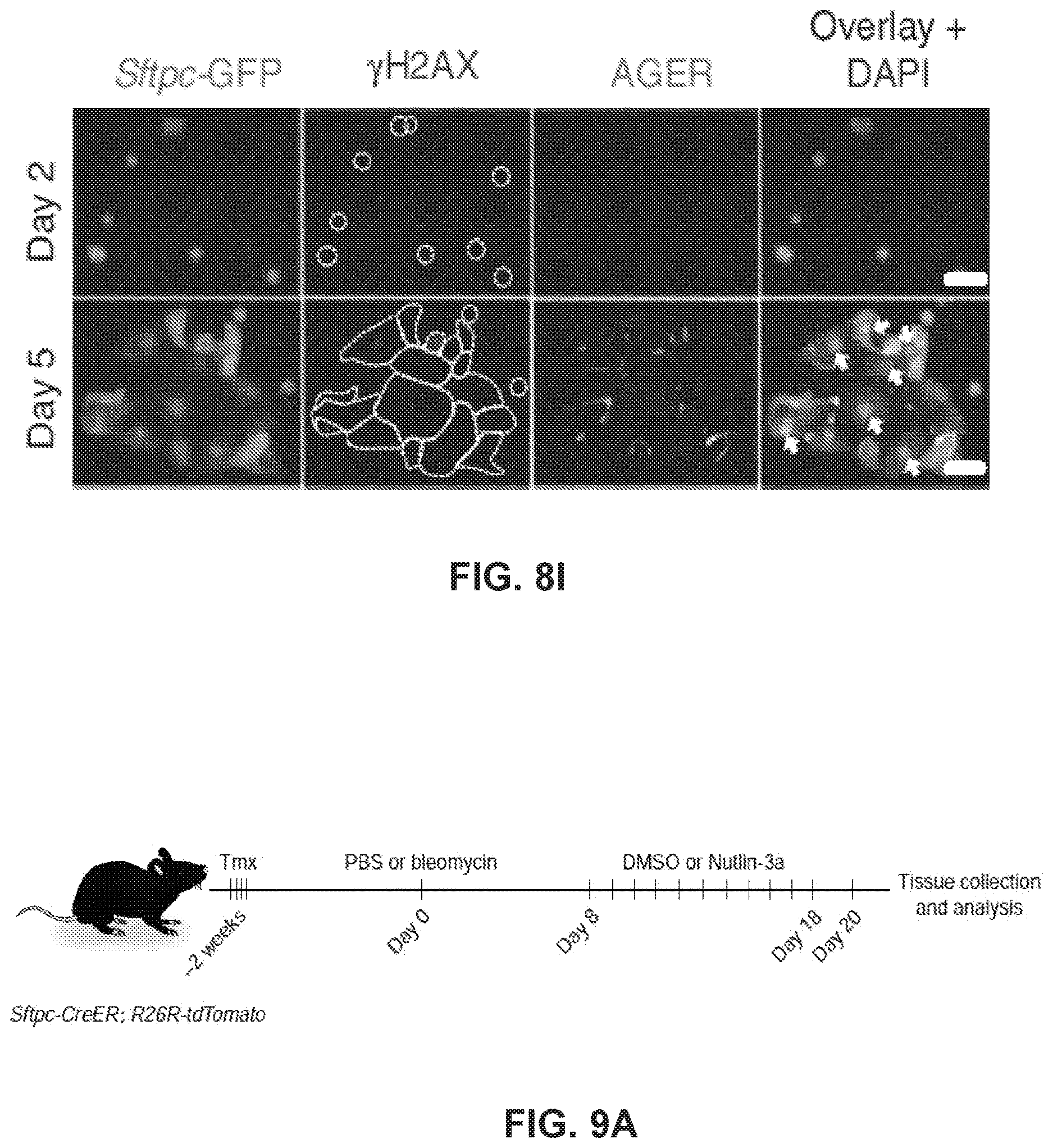 Patent US12613236 Figure 20 – Lung fibrosis model and methods of using the same