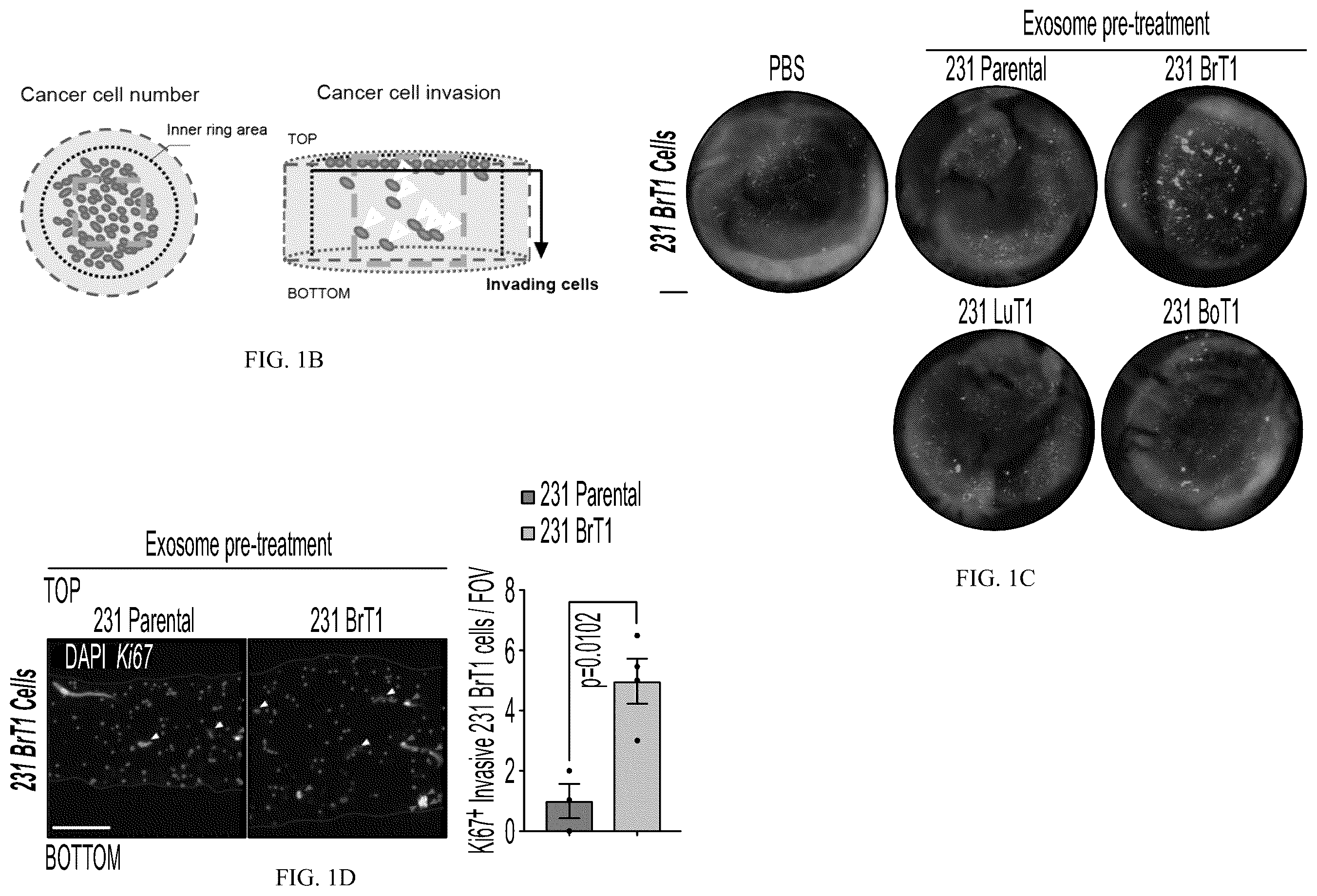 Patent US12613245 Figure 2 – Methods for detecting and inhibiting brain metastasis