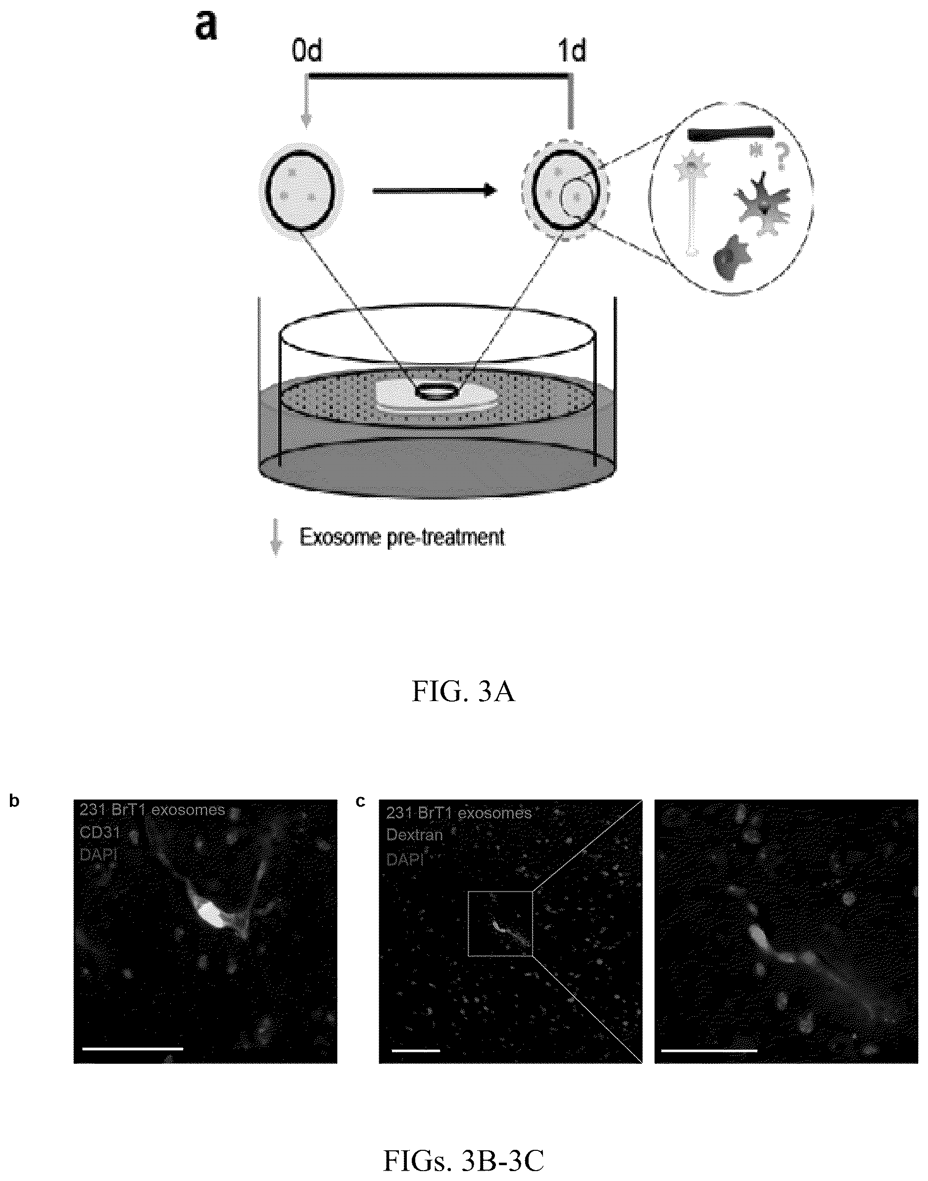 Patent US12613245 Figure 6 – Methods for detecting and inhibiting brain metastasis