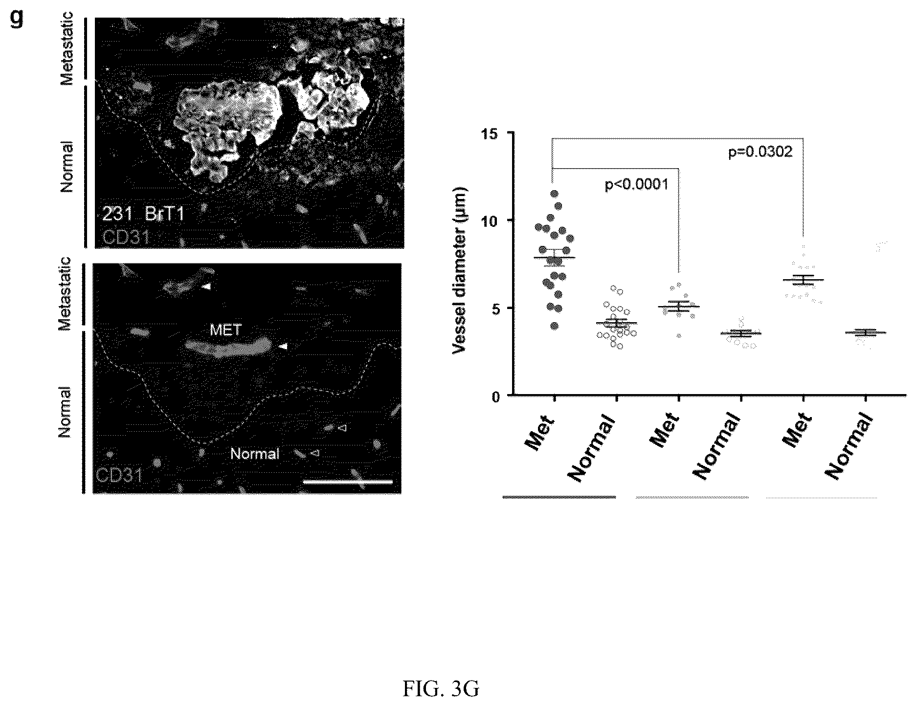 Patent US12613245 Figure 9 – Methods for detecting and inhibiting brain metastasis