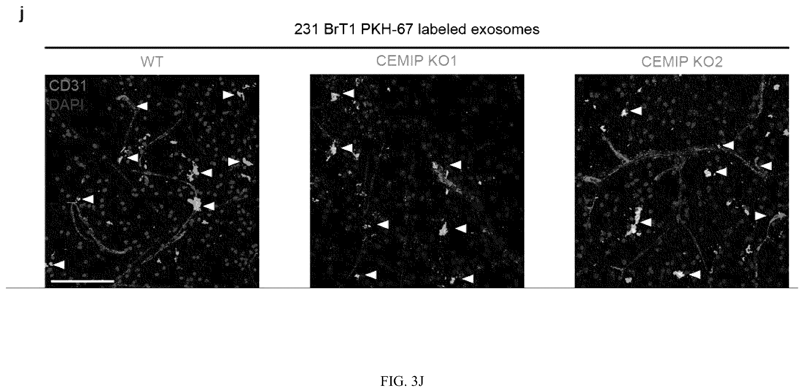 Patent US12613245 Figure 11 – Methods for detecting and inhibiting brain metastasis