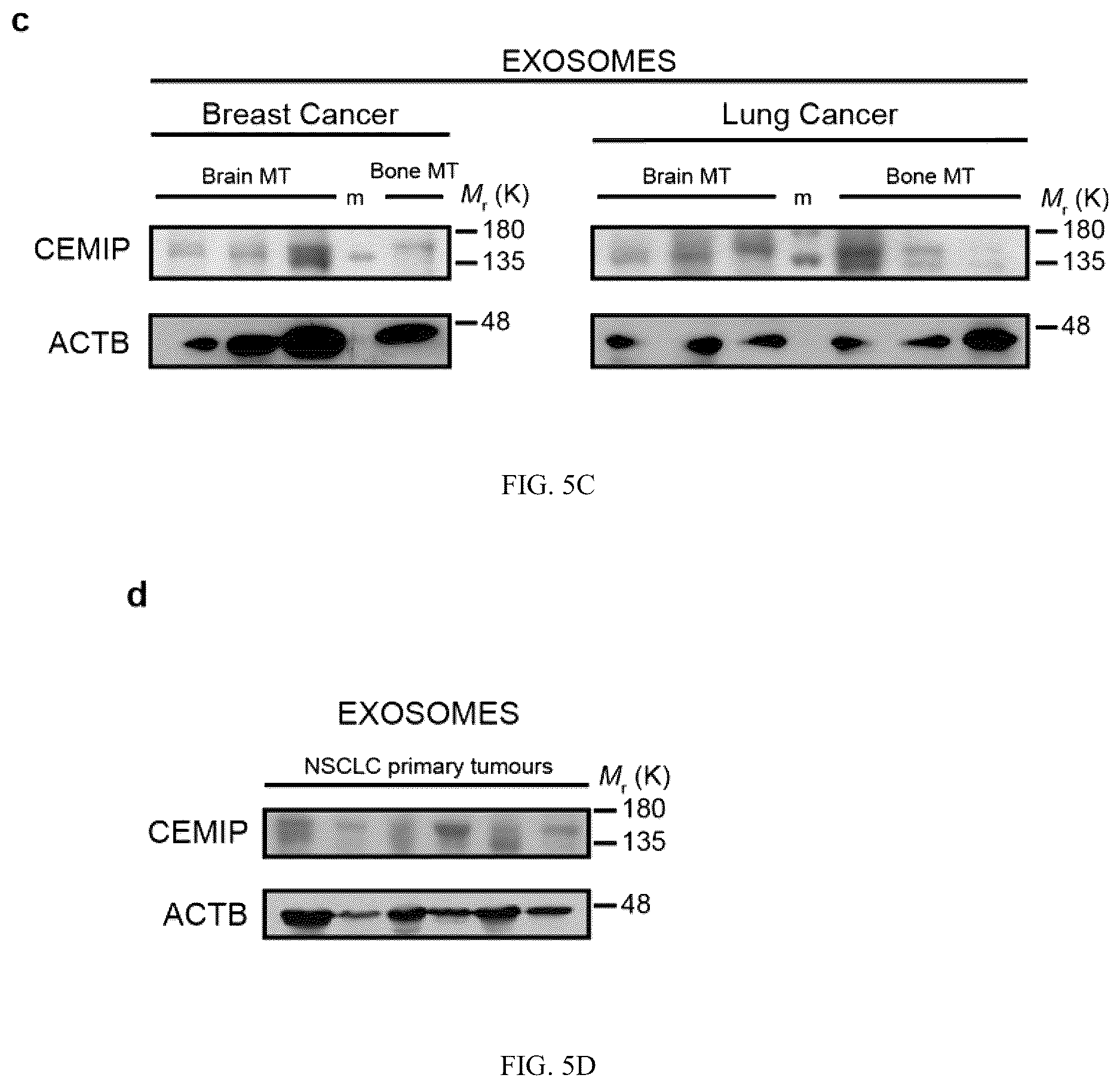 Patent US12613245 Figure 15 – Methods for detecting and inhibiting brain metastasis