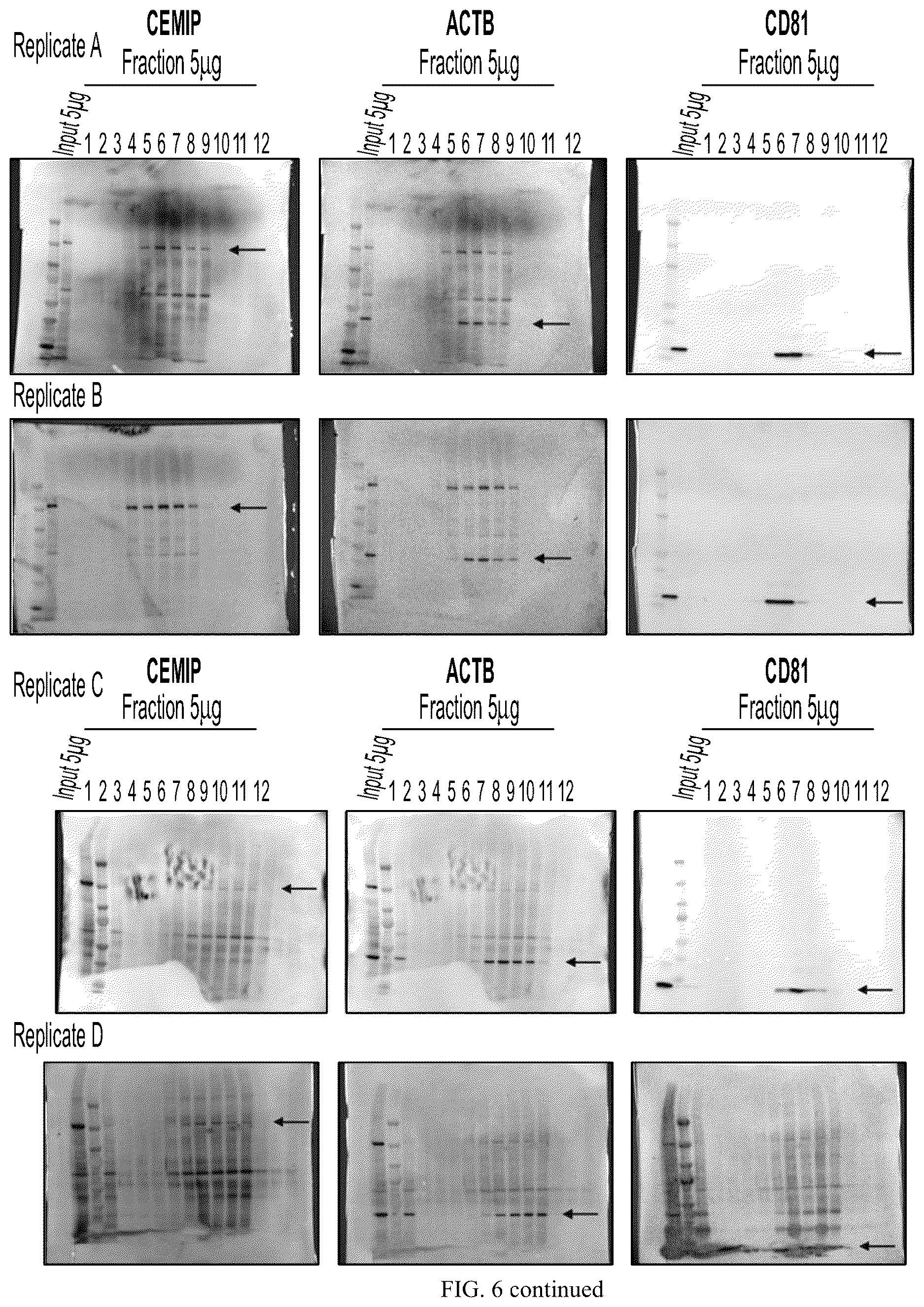 Patent US12613245 Figure 18 – Methods for detecting and inhibiting brain metastasis