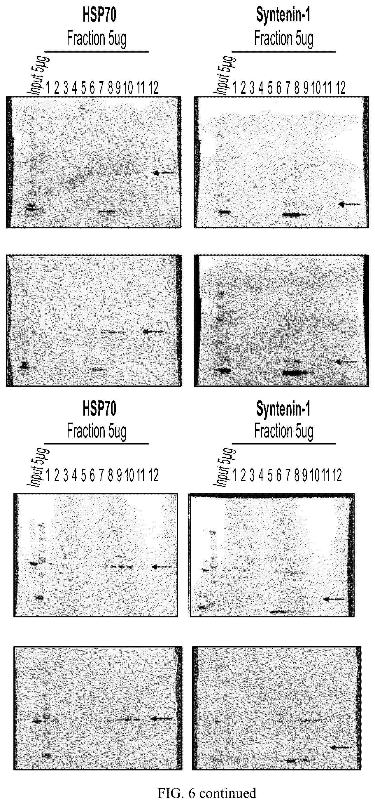 Patent US12613245 Figure 19 – Methods for detecting and inhibiting brain metastasis