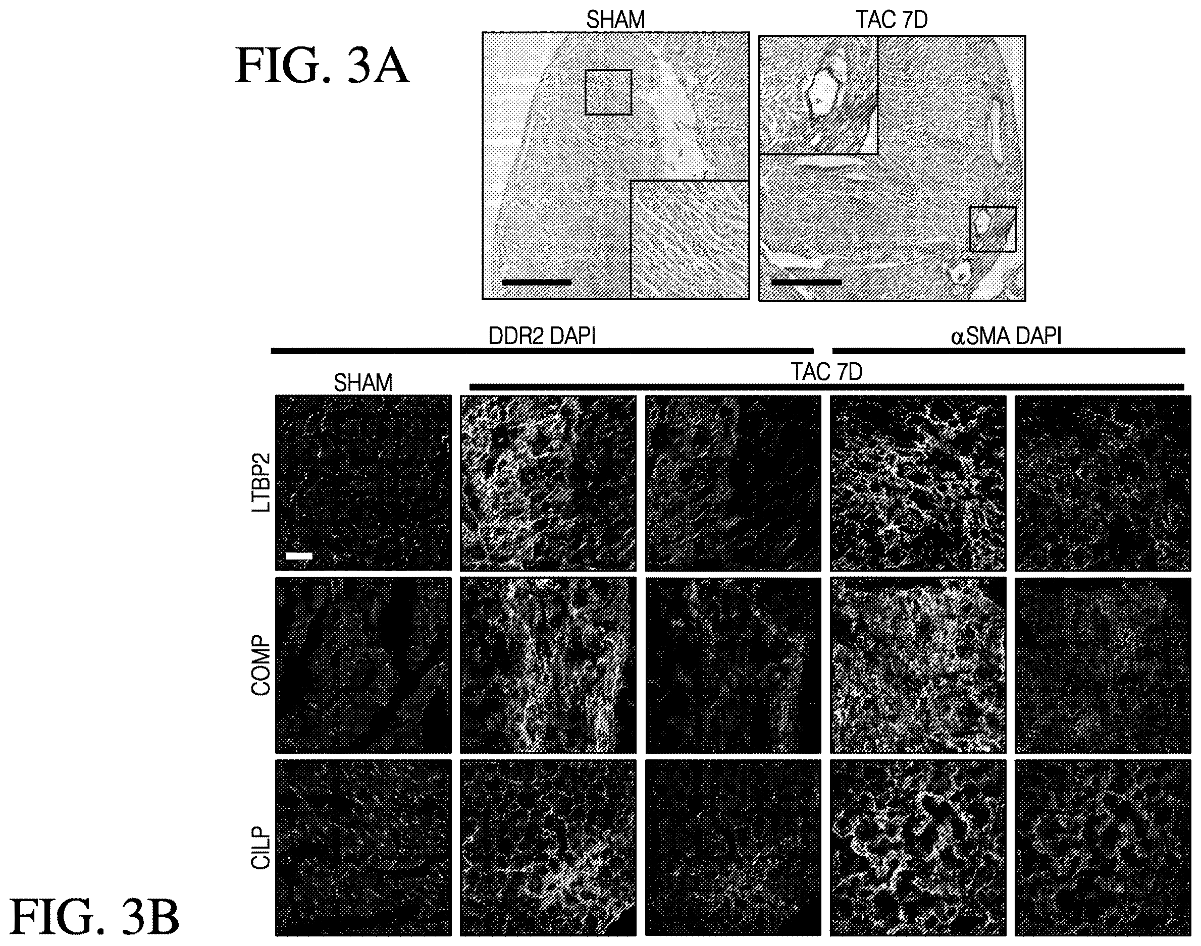 Patent US12613248 Figure 3 – Full-length CILP as a biomarker for cardiac fibrosis