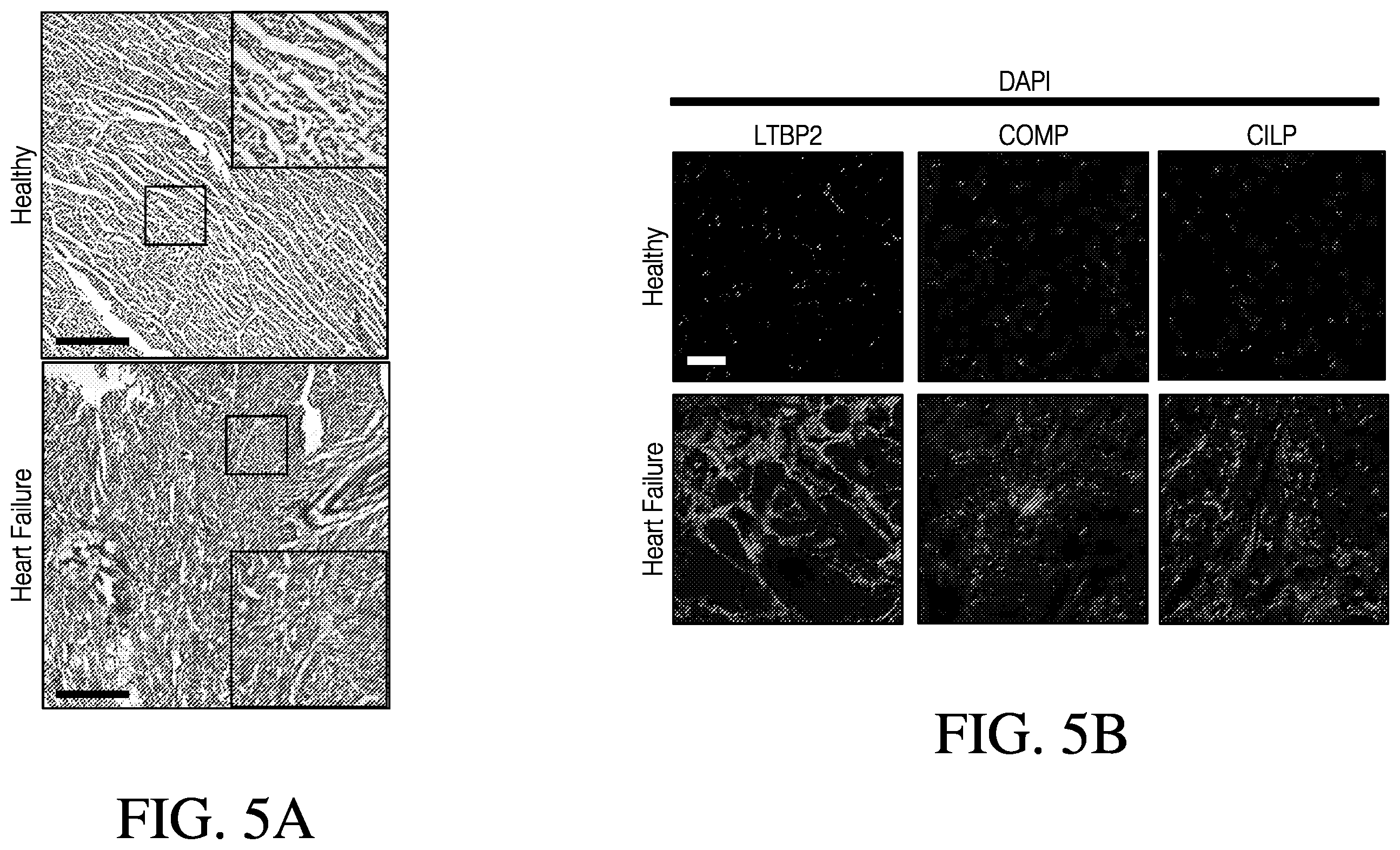 Patent US12613248 Figure 5 – Full-length CILP as a biomarker for cardiac fibrosis