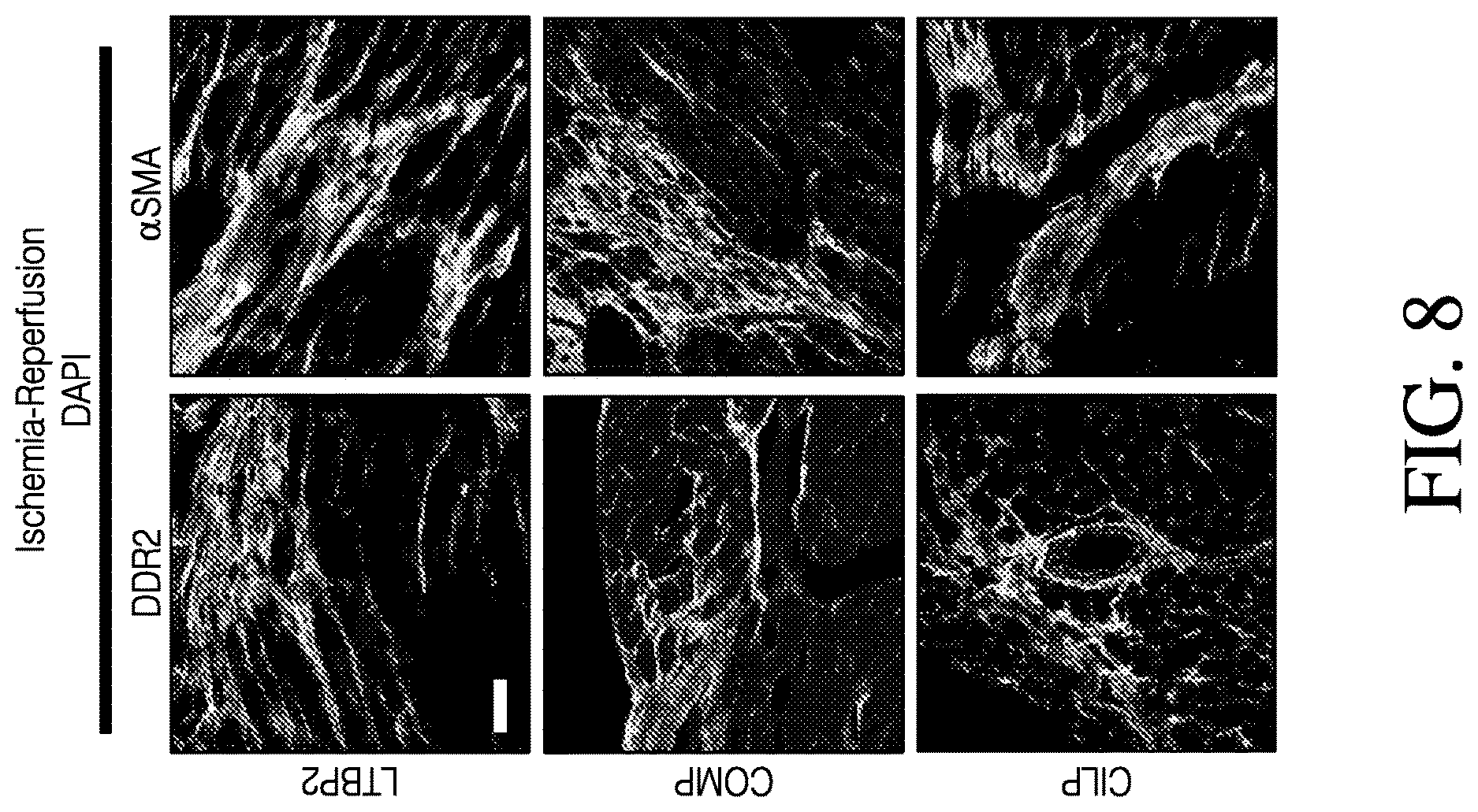 Patent US12613248 Figure 8 – Full-length CILP as a biomarker for cardiac fibrosis