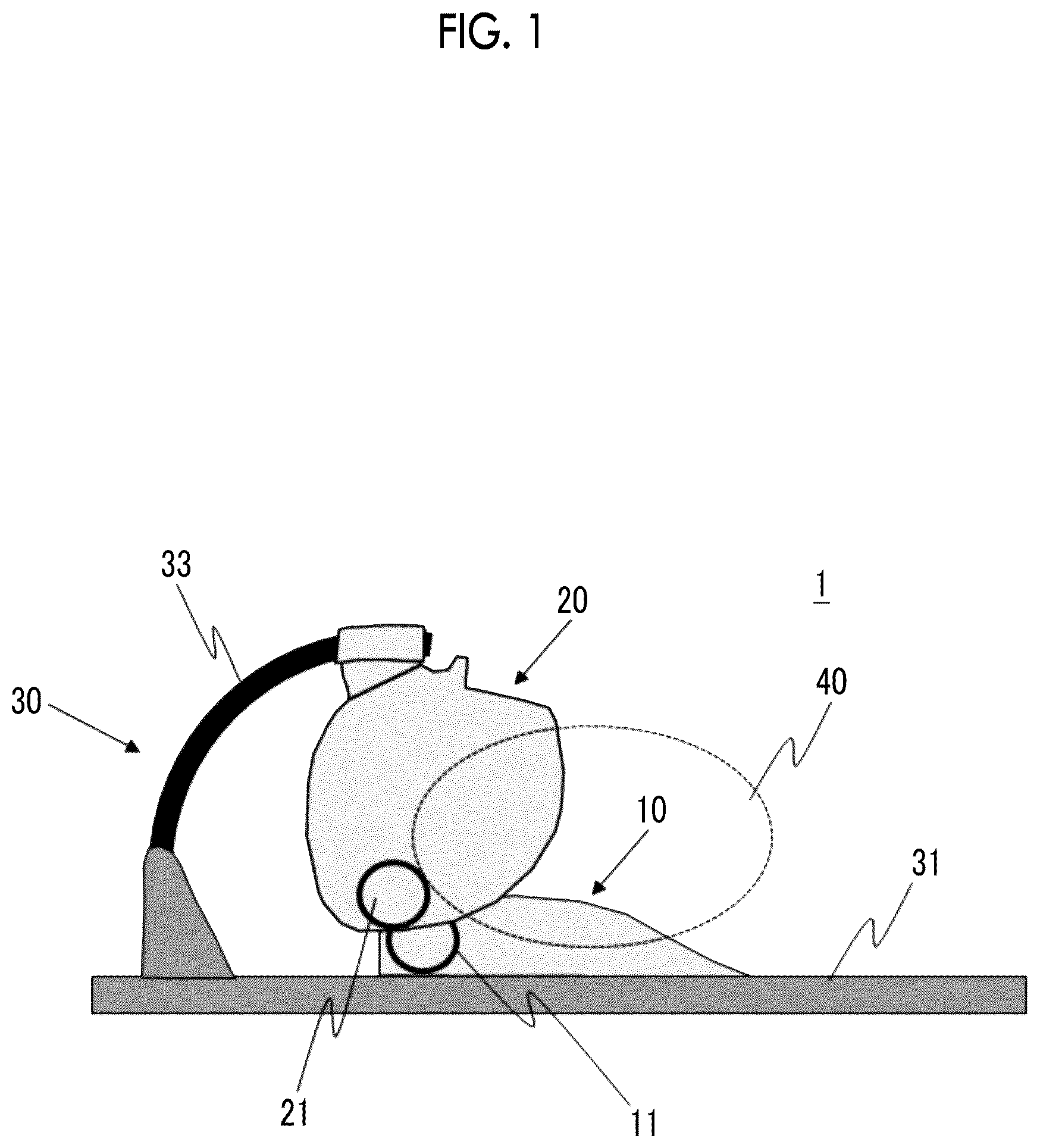 Patent US12613296 Figure 1 – High-frequency coil device and magnetic resonance imaging apparatus using the same