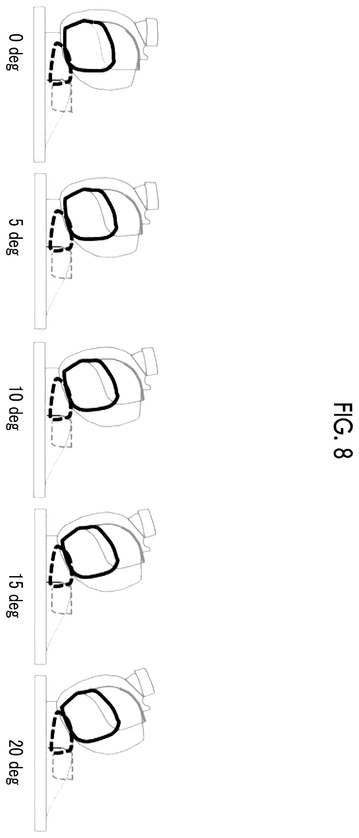 Patent US12613296 Figure 8 – High-frequency coil device and magnetic resonance imaging apparatus using the same