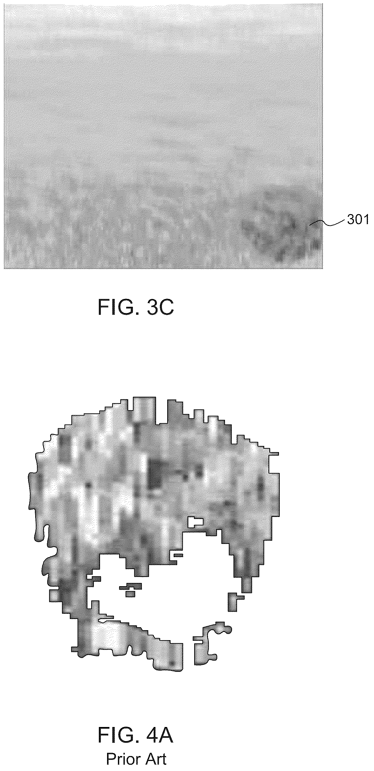 Patent US12613323 Figure 4 – Ultrasound system and method