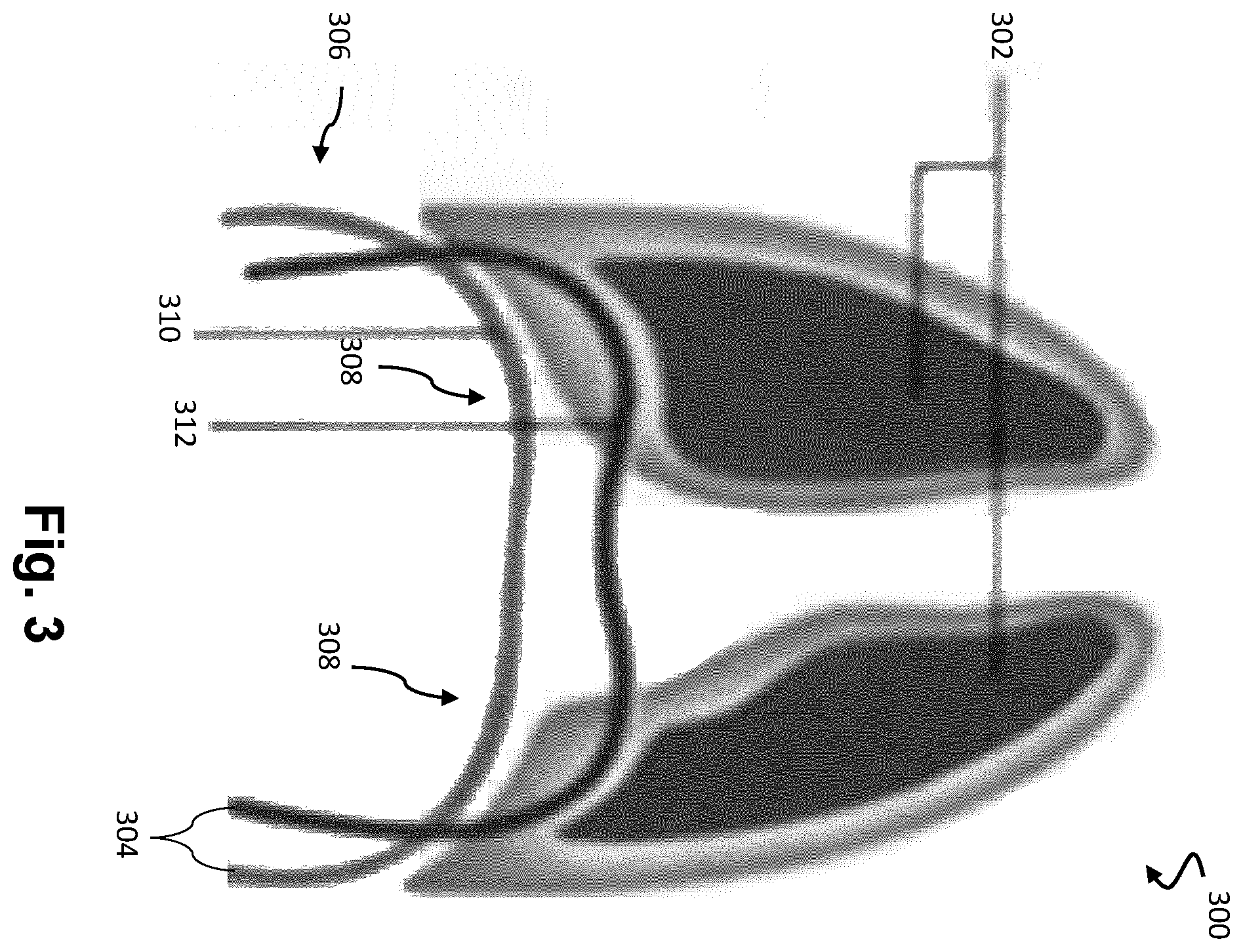 Patent US12613336 Figure 3 – Ultrasound imaging with anatomy-based acoustic settings