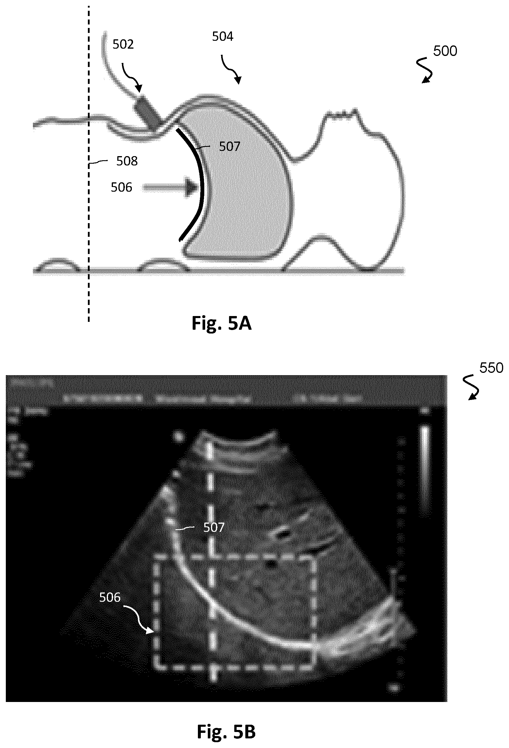 Patent US12613336 Figure 5 – Ultrasound imaging with anatomy-based acoustic settings