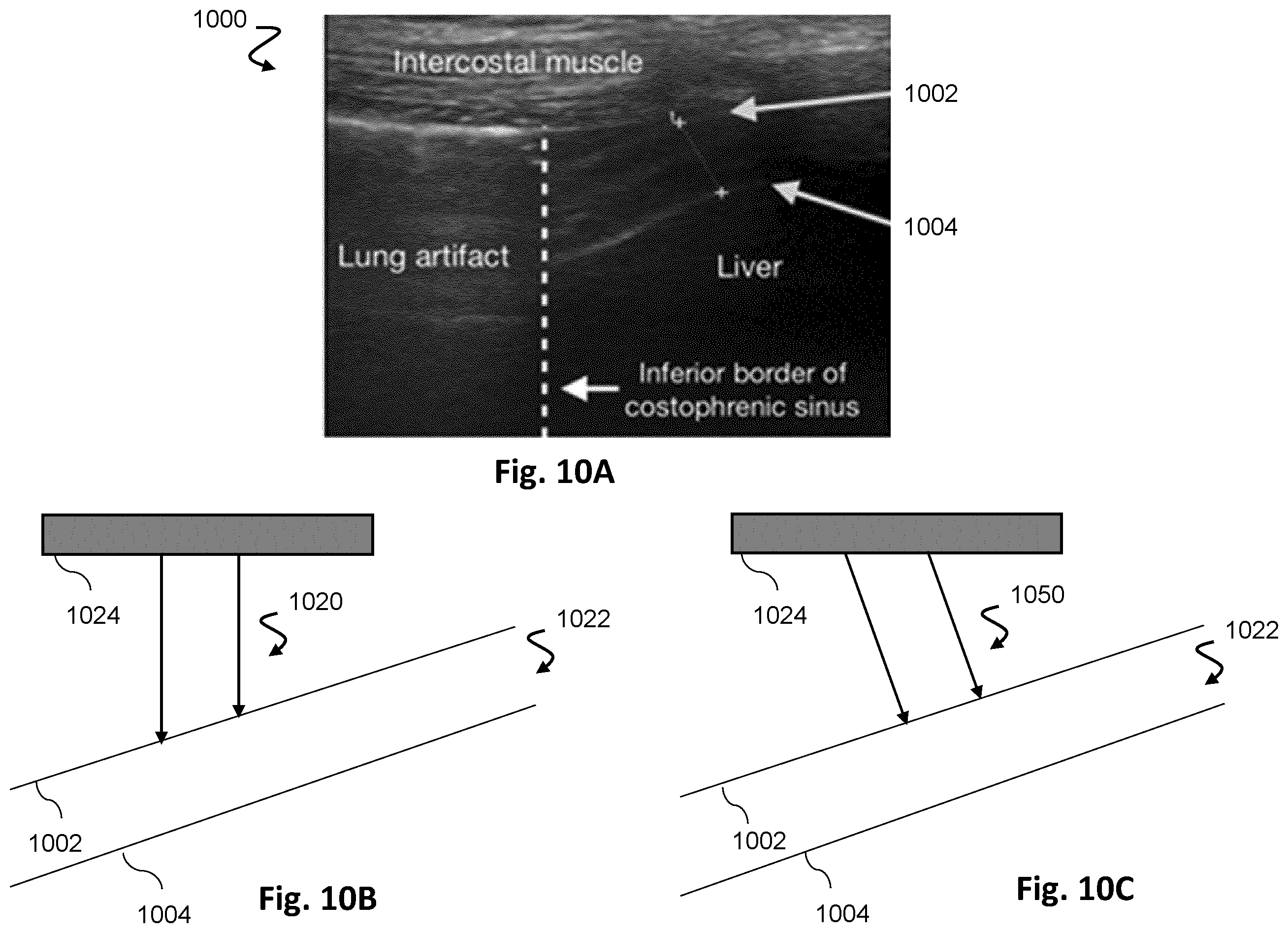Patent US12613336 Figure 10 – Ultrasound imaging with anatomy-based acoustic settings