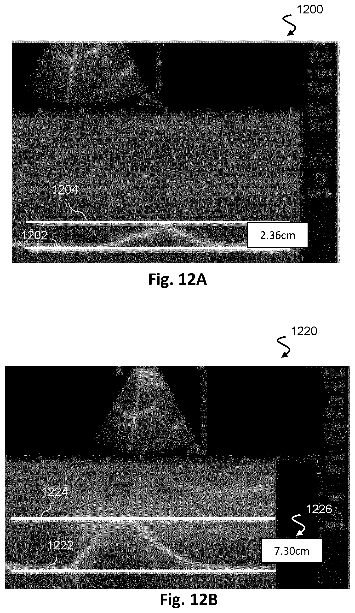 Patent US12613336 Figure 12 – Ultrasound imaging with anatomy-based acoustic settings