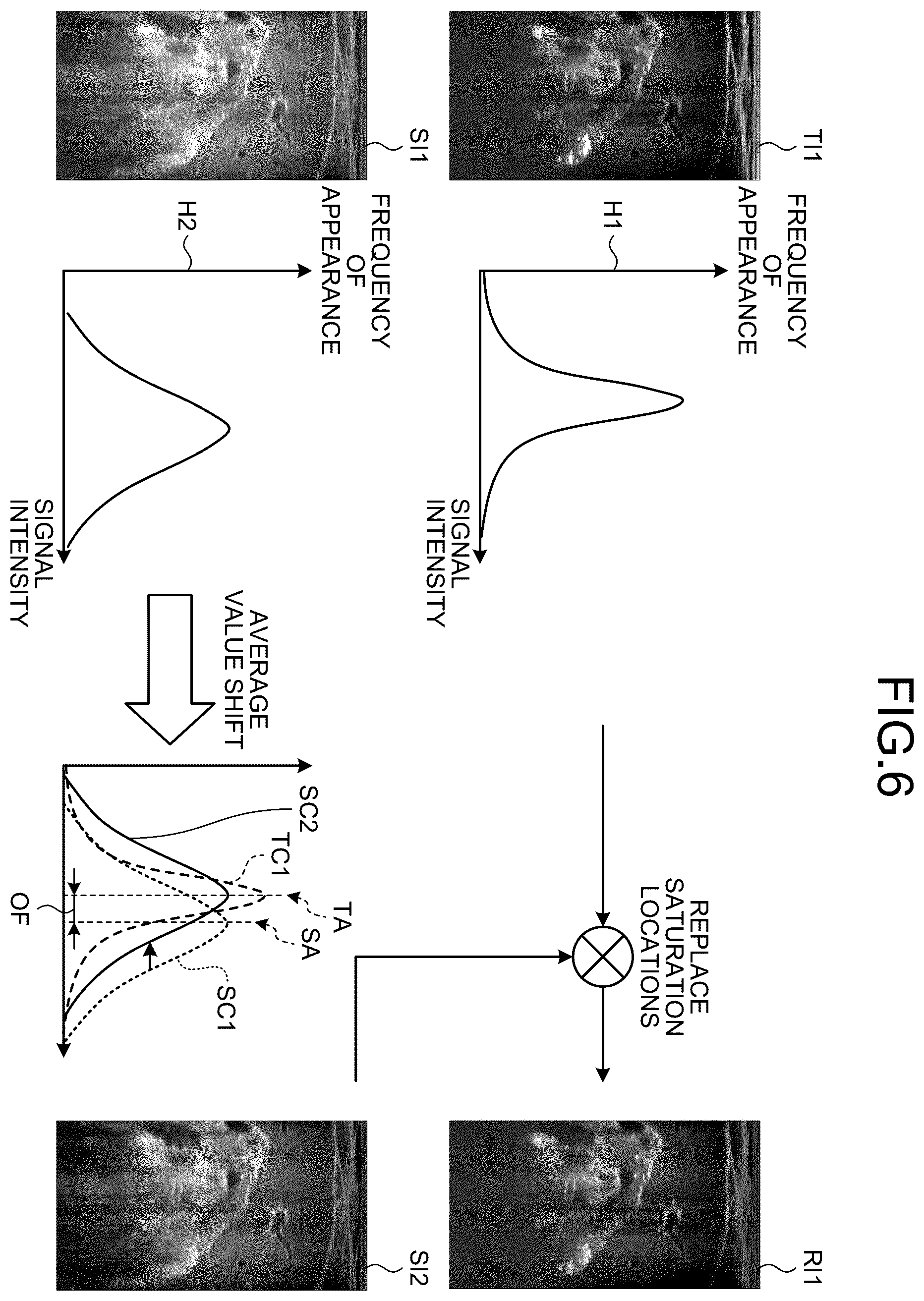 Patent US12613337 Figure 6 – Ultrasound diagnosis apparatus to correct a saturation region in an ultrasound image