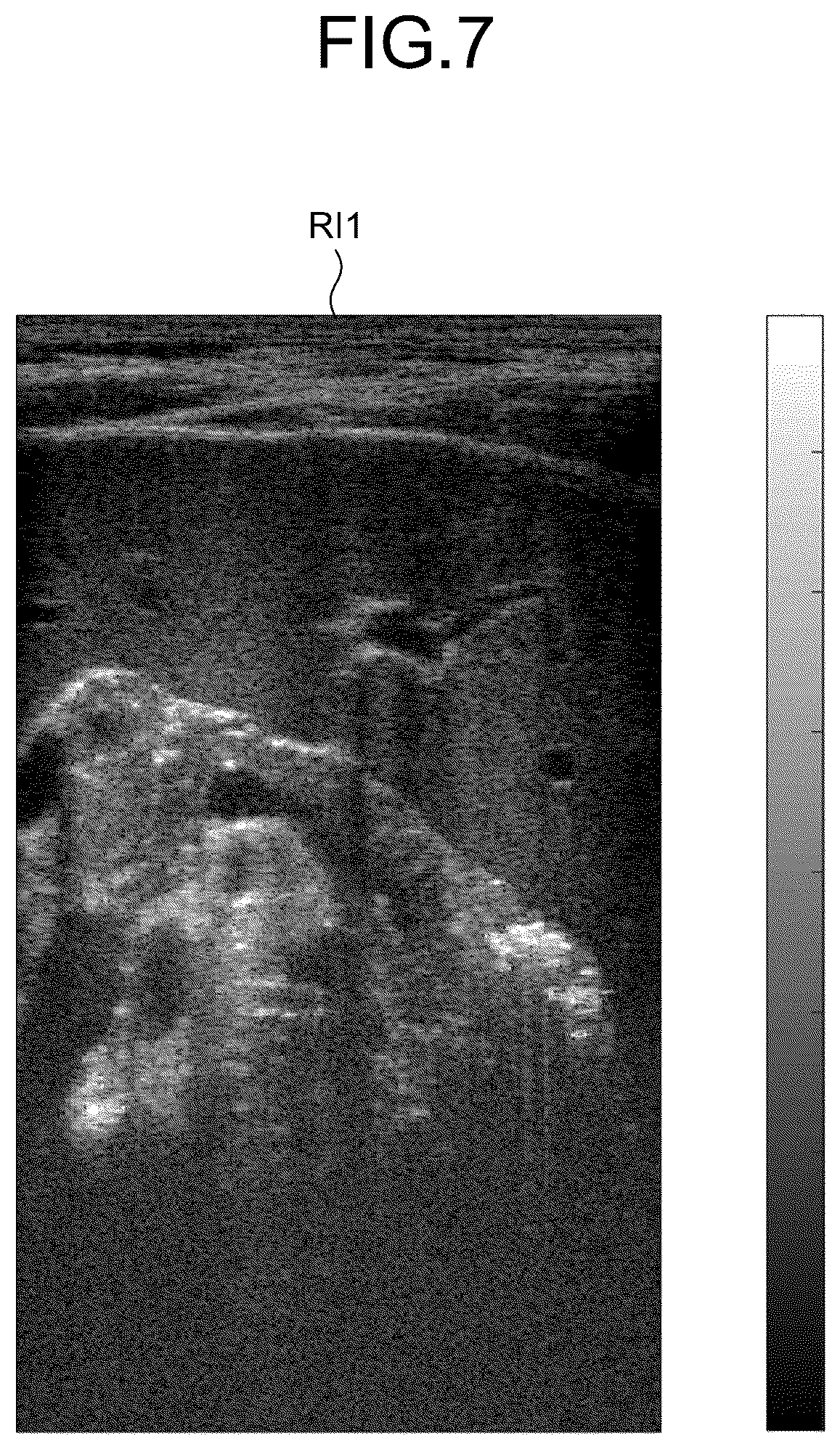 Patent US12613337 Figure 7 – Ultrasound diagnosis apparatus to correct a saturation region in an ultrasound image