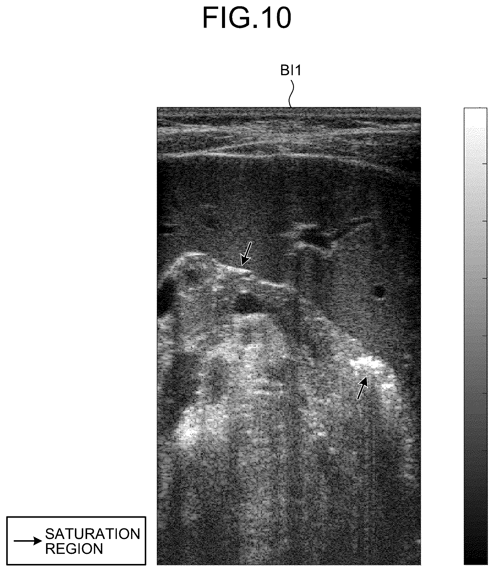 Patent US12613337 Figure 10 – Ultrasound diagnosis apparatus to correct a saturation region in an ultrasound image