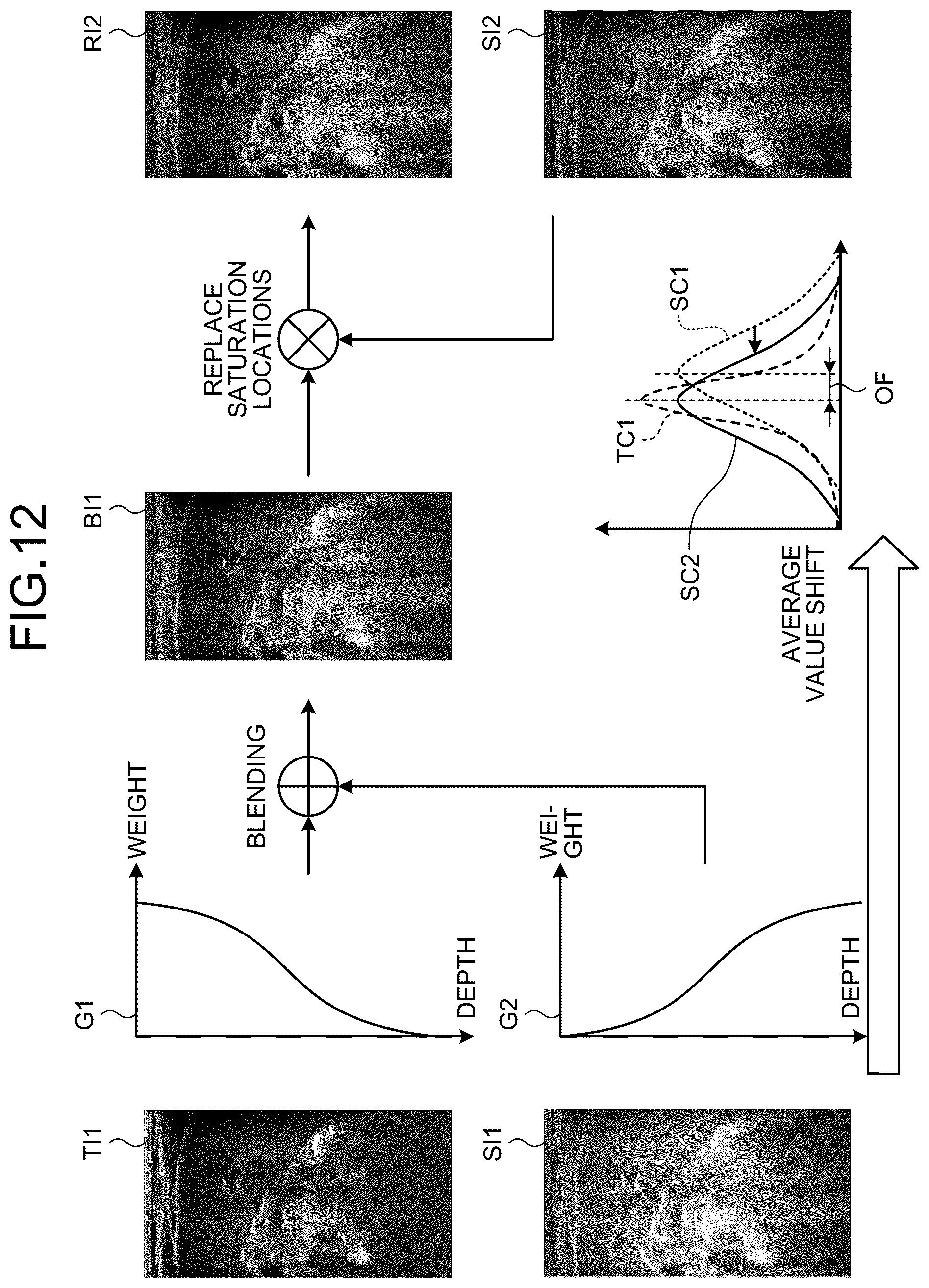 Patent US12613337 Figure 12 – Ultrasound diagnosis apparatus to correct a saturation region in an ultrasound image