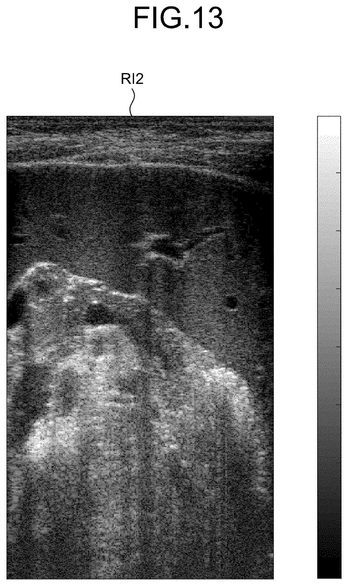 Patent US12613337 Figure 13 – Ultrasound diagnosis apparatus to correct a saturation region in an ultrasound image