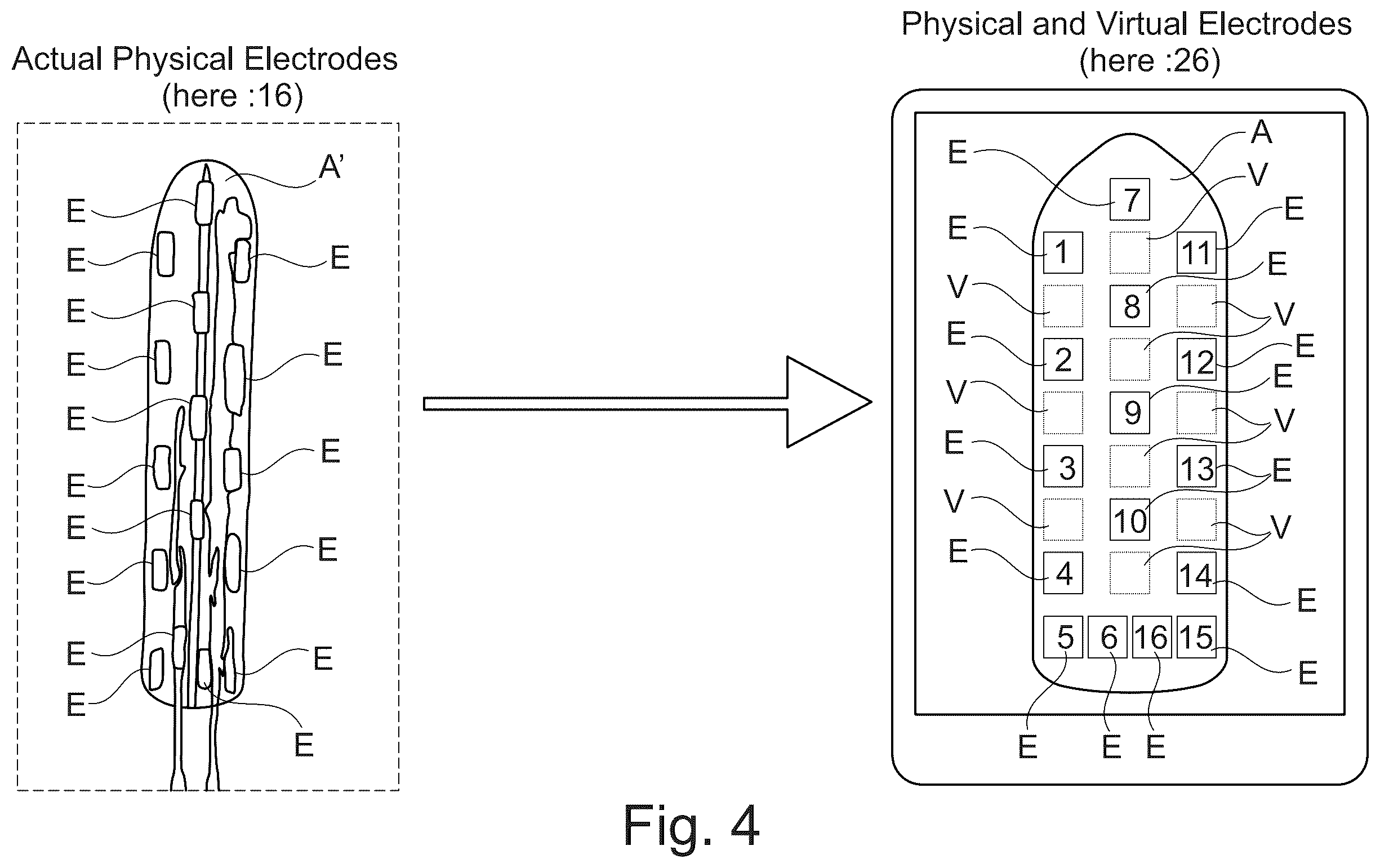 Patent US12613624 Figure 3 – Planning and/or control system for a neuromodulation system