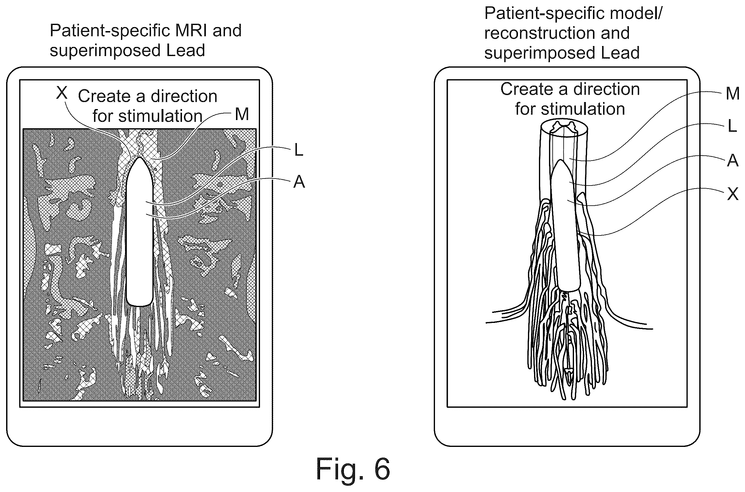 Patent US12613624 Figure 5 – Planning and/or control system for a neuromodulation system