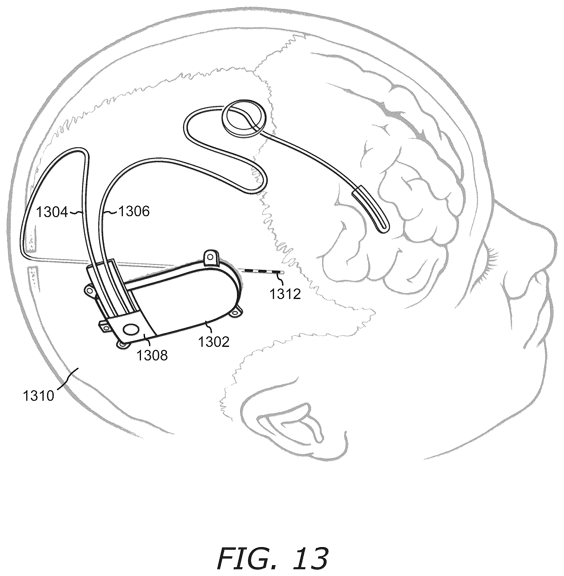 Patent US12614117 Figure 18 – Systems and methods for labeling large datasets of physiological records based on unsupervised machine learning