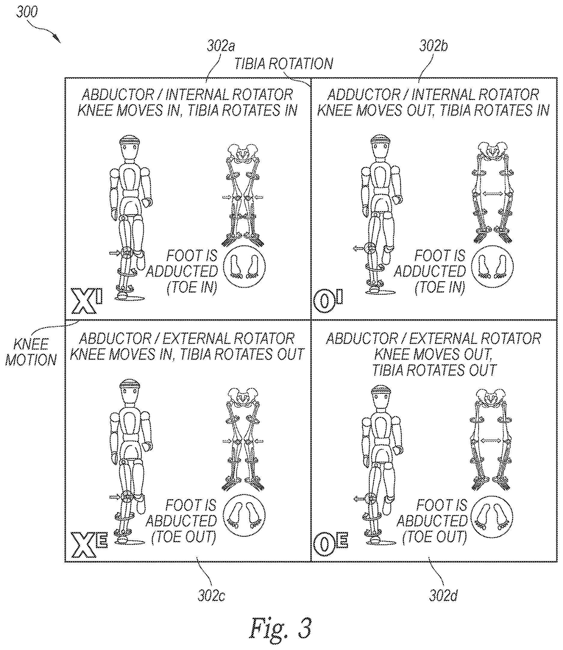 Patent US12614220 Figure 3 – Systems and methods for analyzing lower body movement to recommend footwear